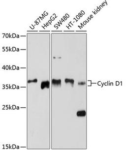 Western blot - Cyclin D1 antibody (A11022)