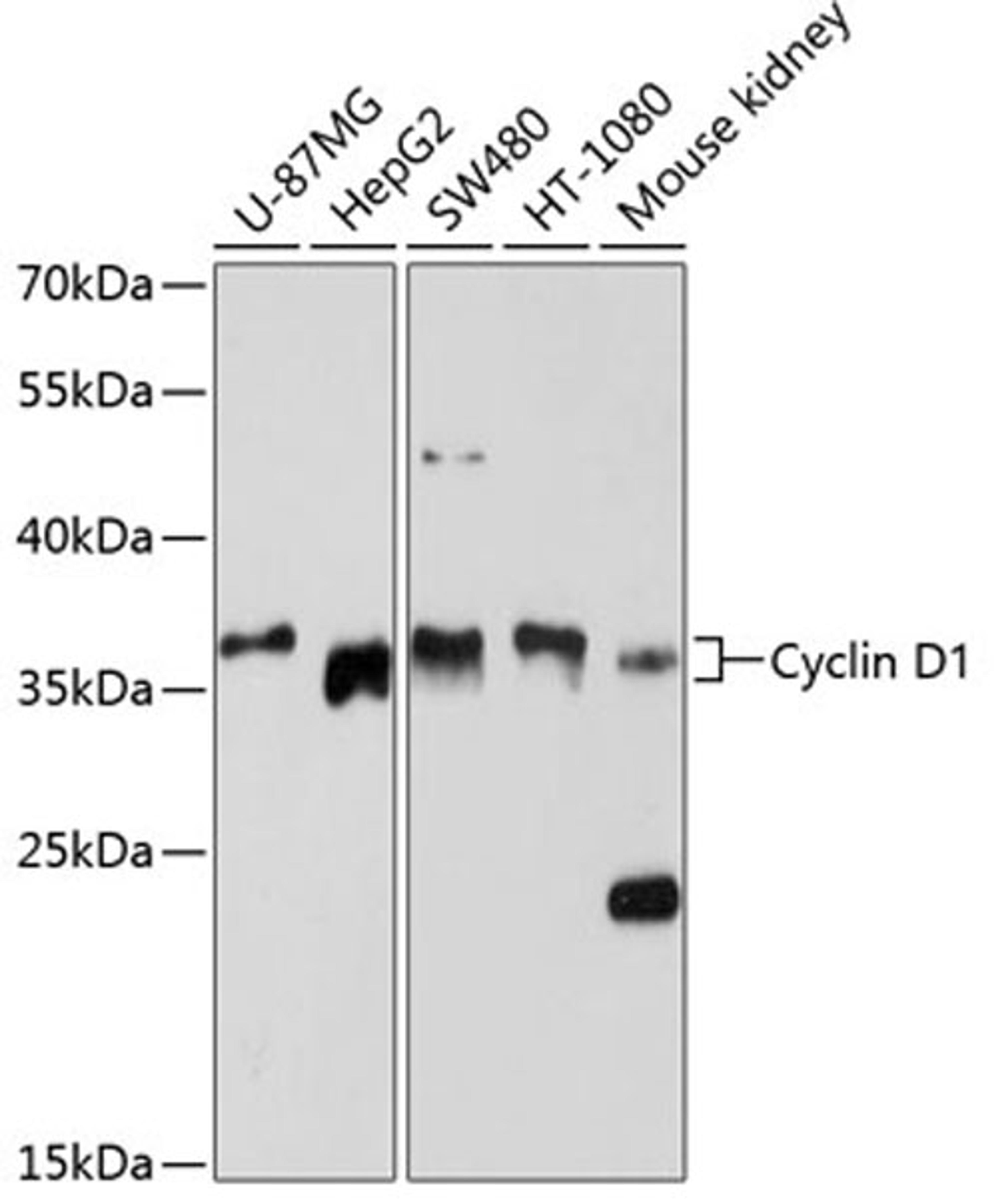 Western blot - Cyclin D1 antibody (A11022)