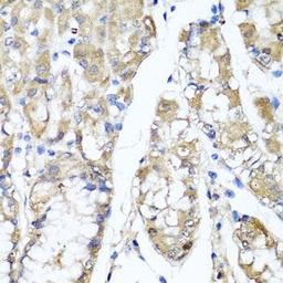 Immunohistochemical staining of human gastric tissue using TNFAIP6 antibody (dilution of 1:100)