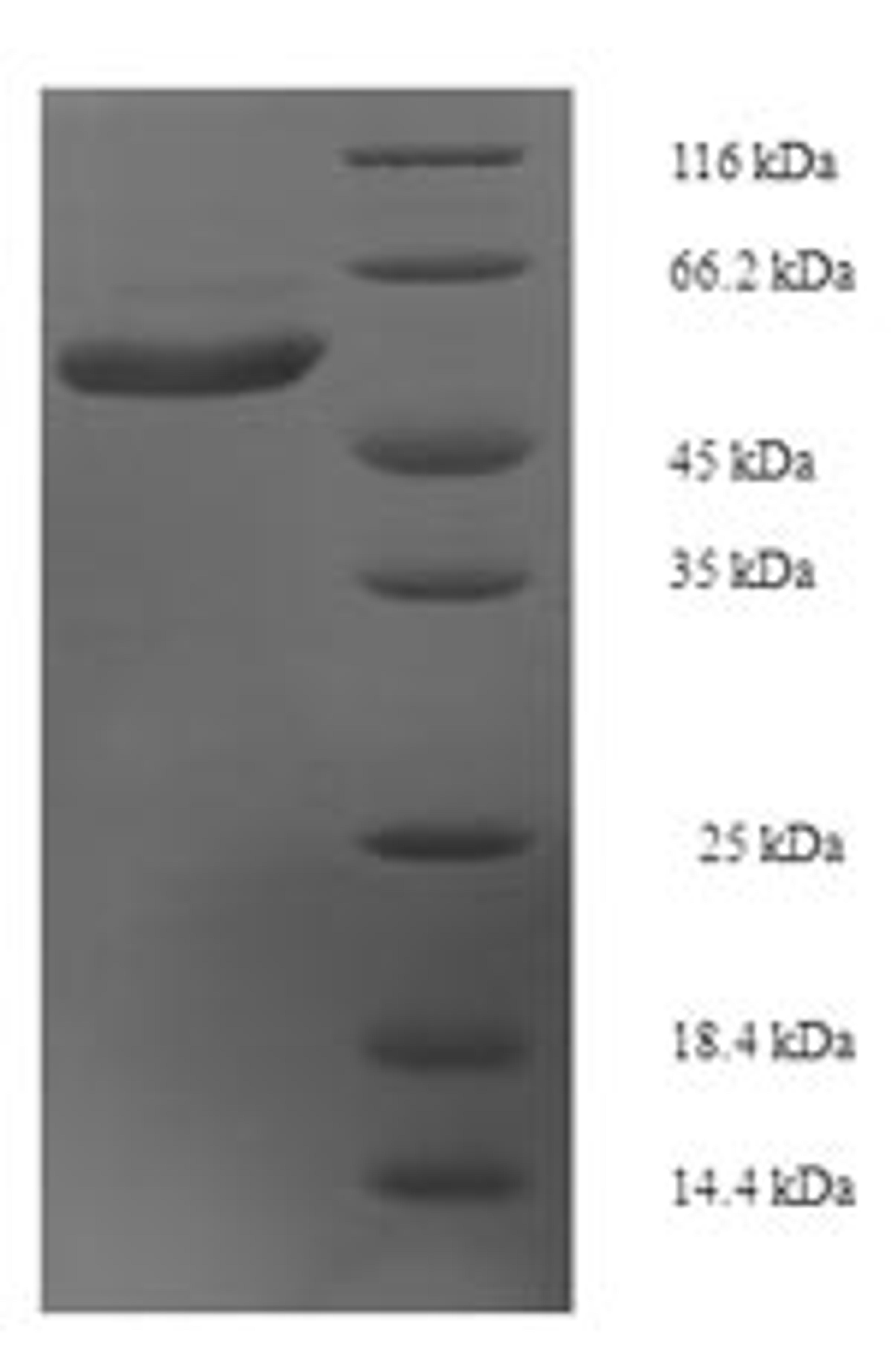 (Tris-Glycine gel) Discontinuous SDS-PAGE (reduced) with 5% enrichment gel and 15% separation gel.