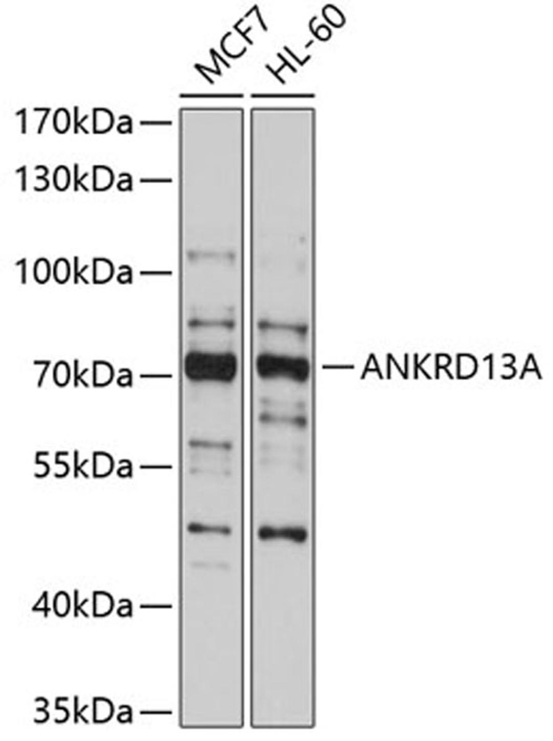 Western blot - ANKRD13A antibody (A10416)