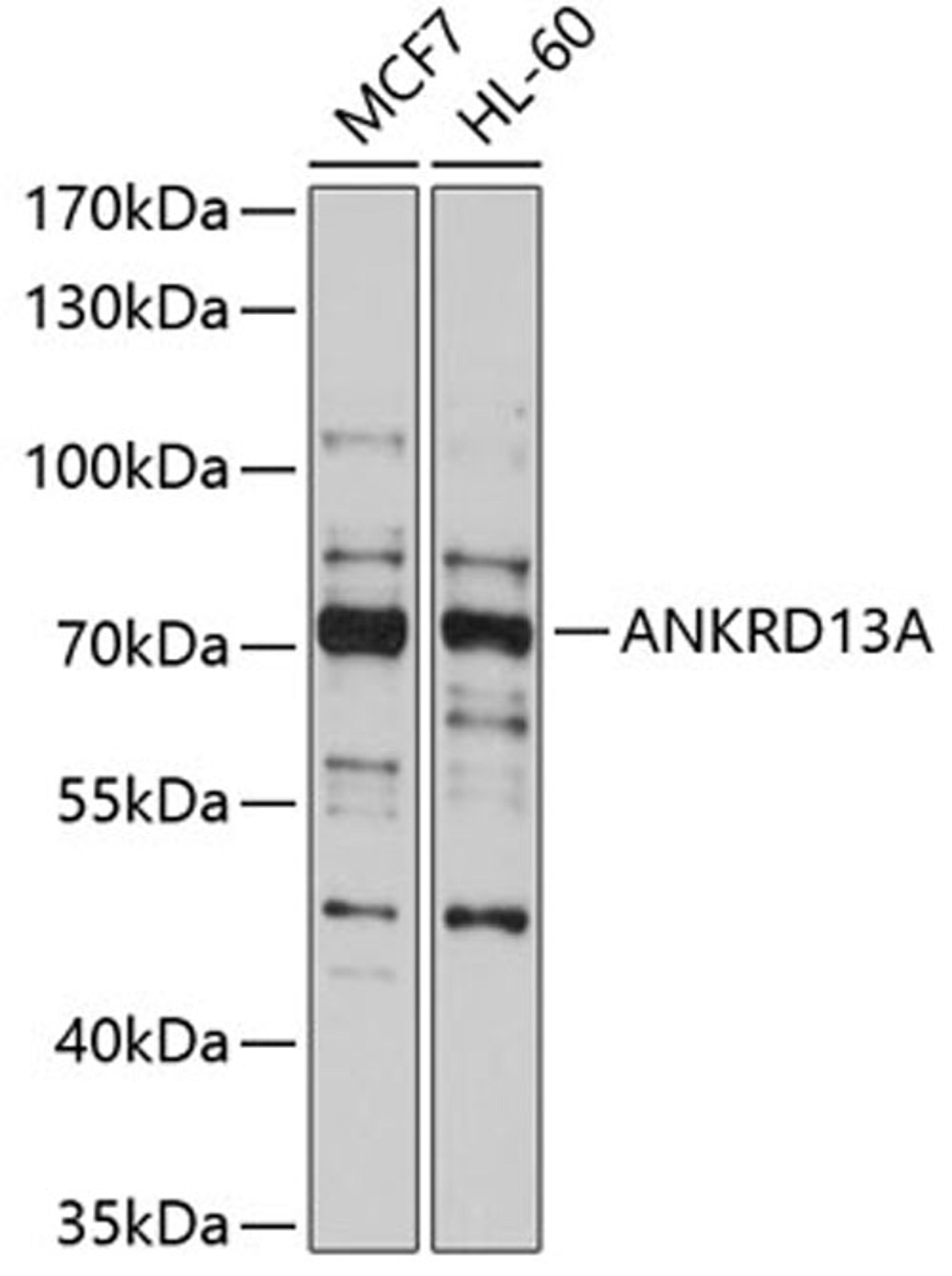 Western blot - ANKRD13A antibody (A10416)