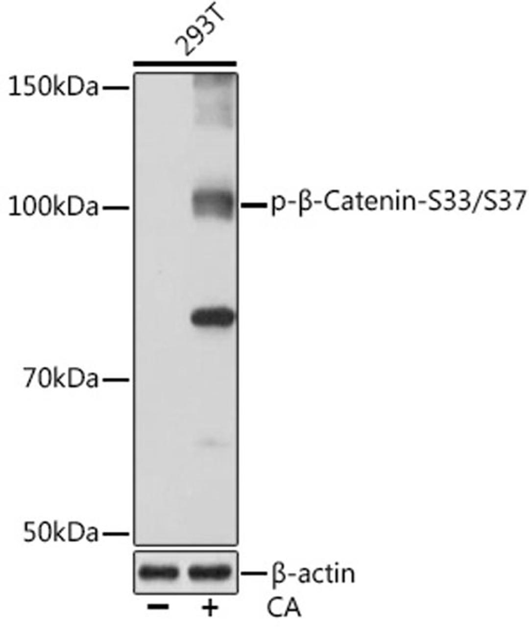 Western blot - Phospho-ß-Catenin-S33/S37 Rabbit mAb (AP0979)