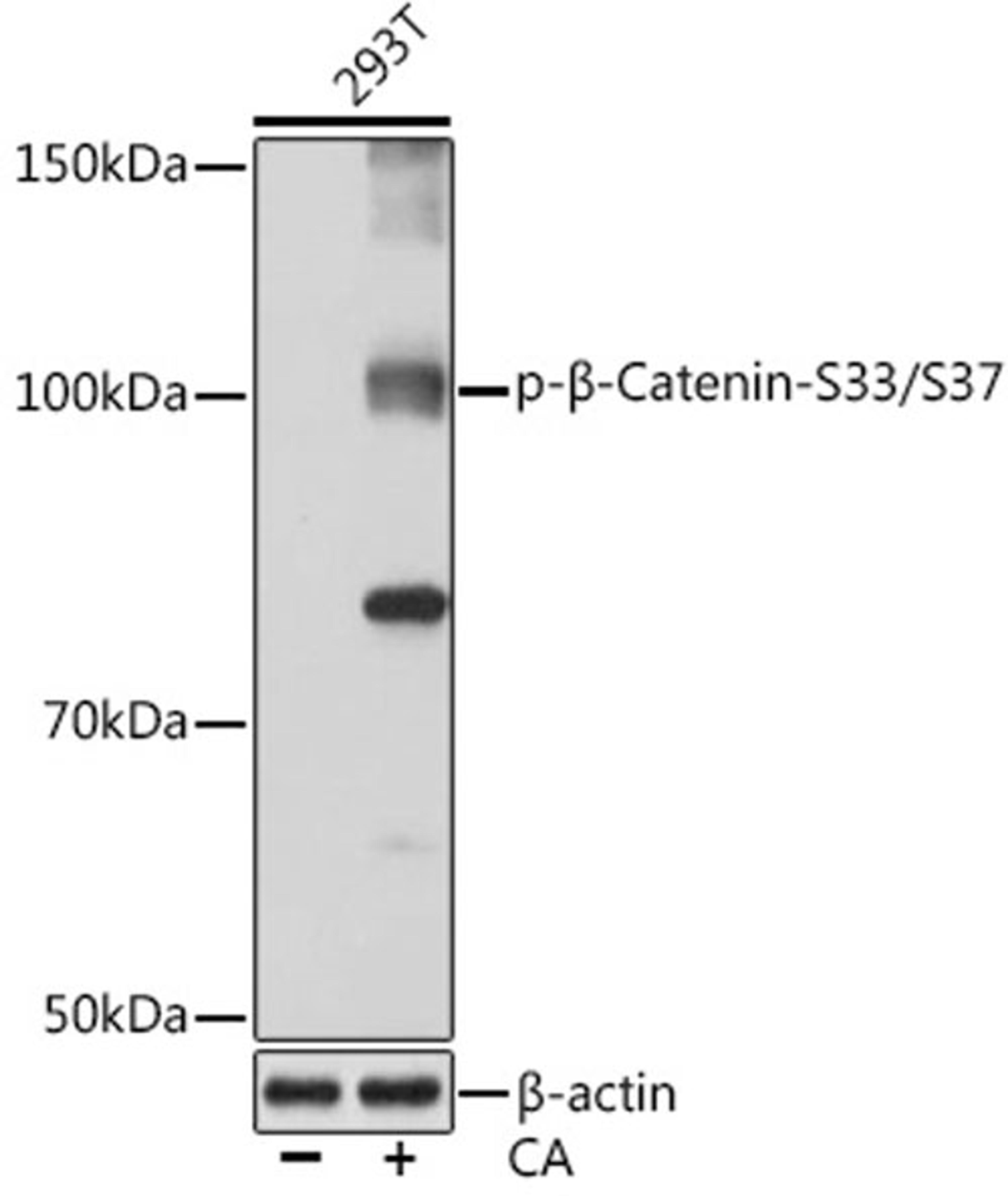 Western blot - Phospho-ß-Catenin-S33/S37 Rabbit mAb (AP0979)