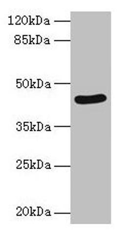 Western blot. All lanes: SERPINB8 antibody at 2µg/ml + Jurkat whole cell lysate. Secondary. Goat polyclonal to rabbit IgG at 1/10000 dilution. Predicted band size: 43, 28, 23 kDa. Observed band size: 43 kDa