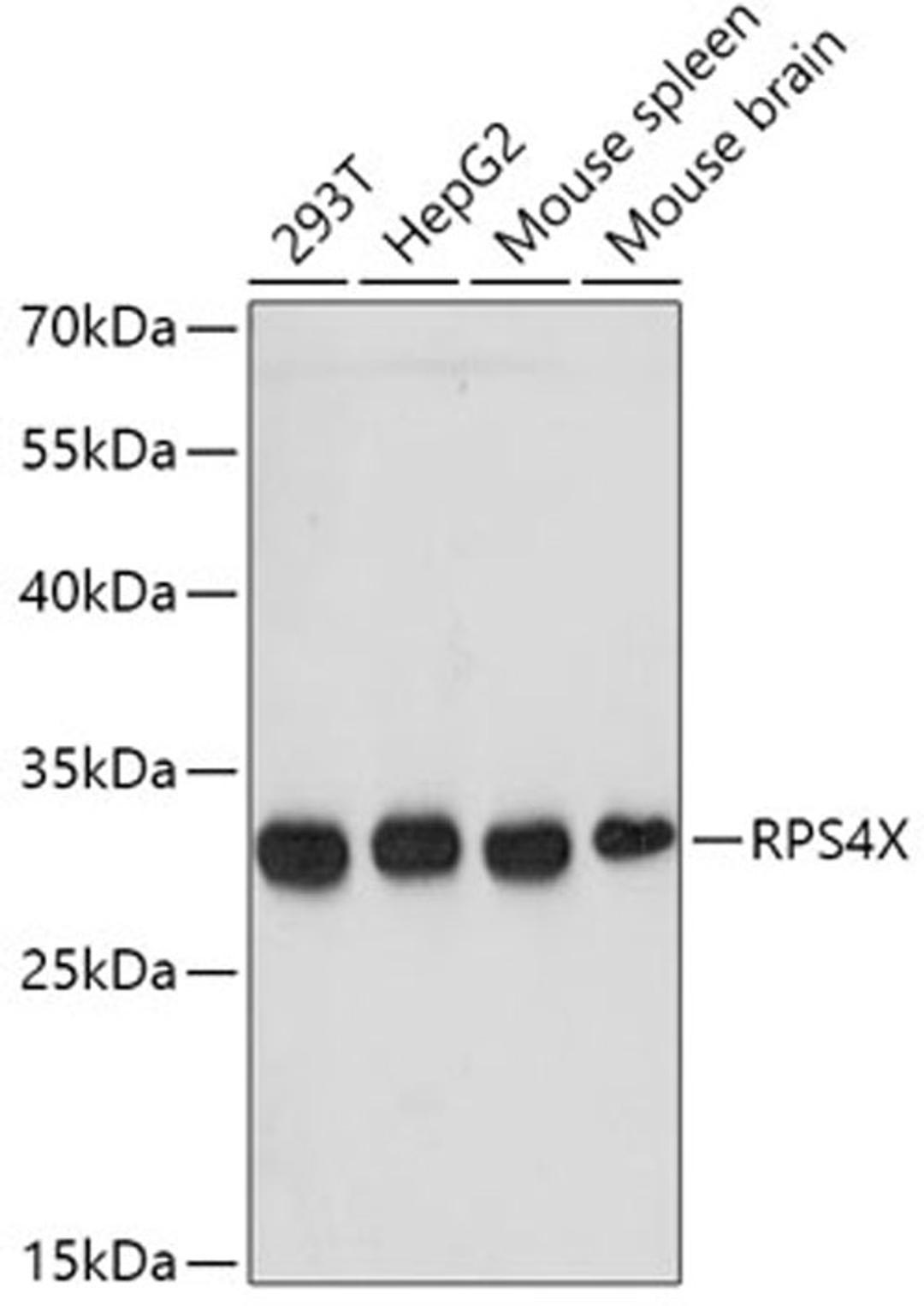 Western blot - RPS4X antibody (A6730)