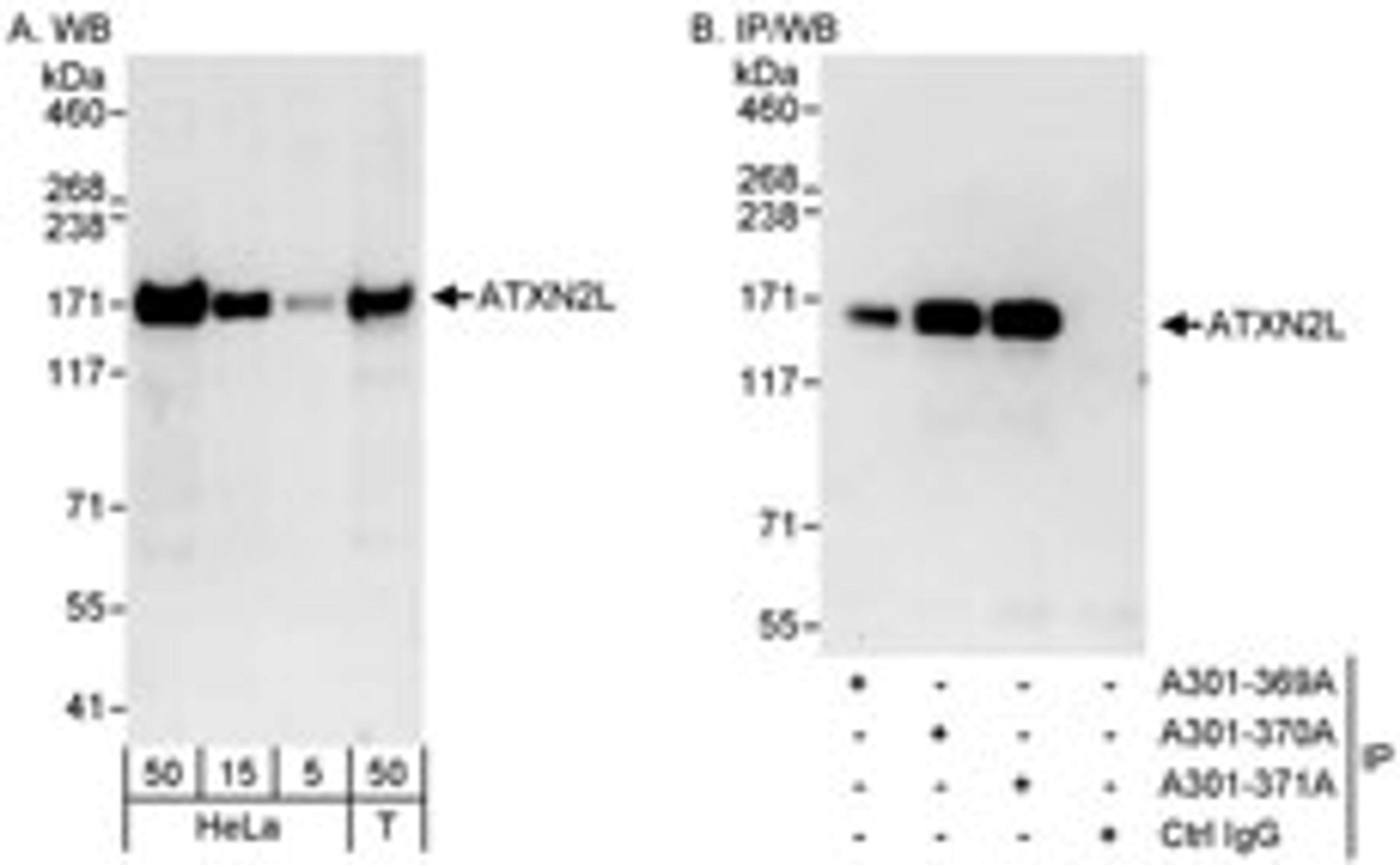 Detection of human ATXN2L by western blot and immunoprecipitation.