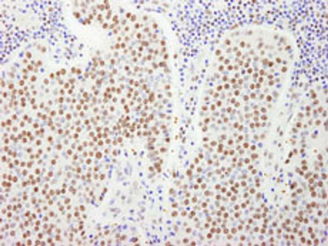 Detection of human FIP1 by immunohistochemistry.