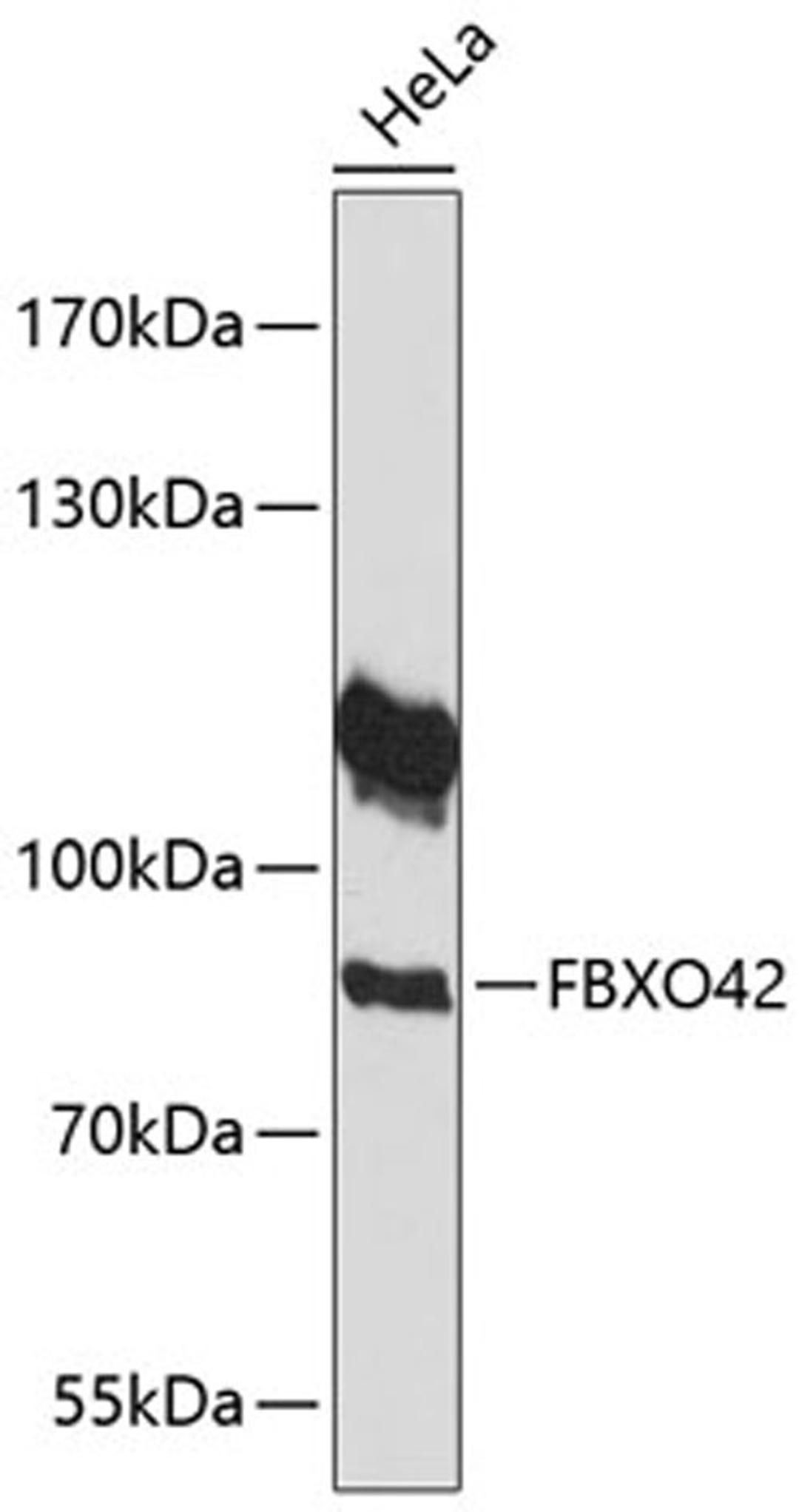 Western blot - FBXO42 antibody (A14899)