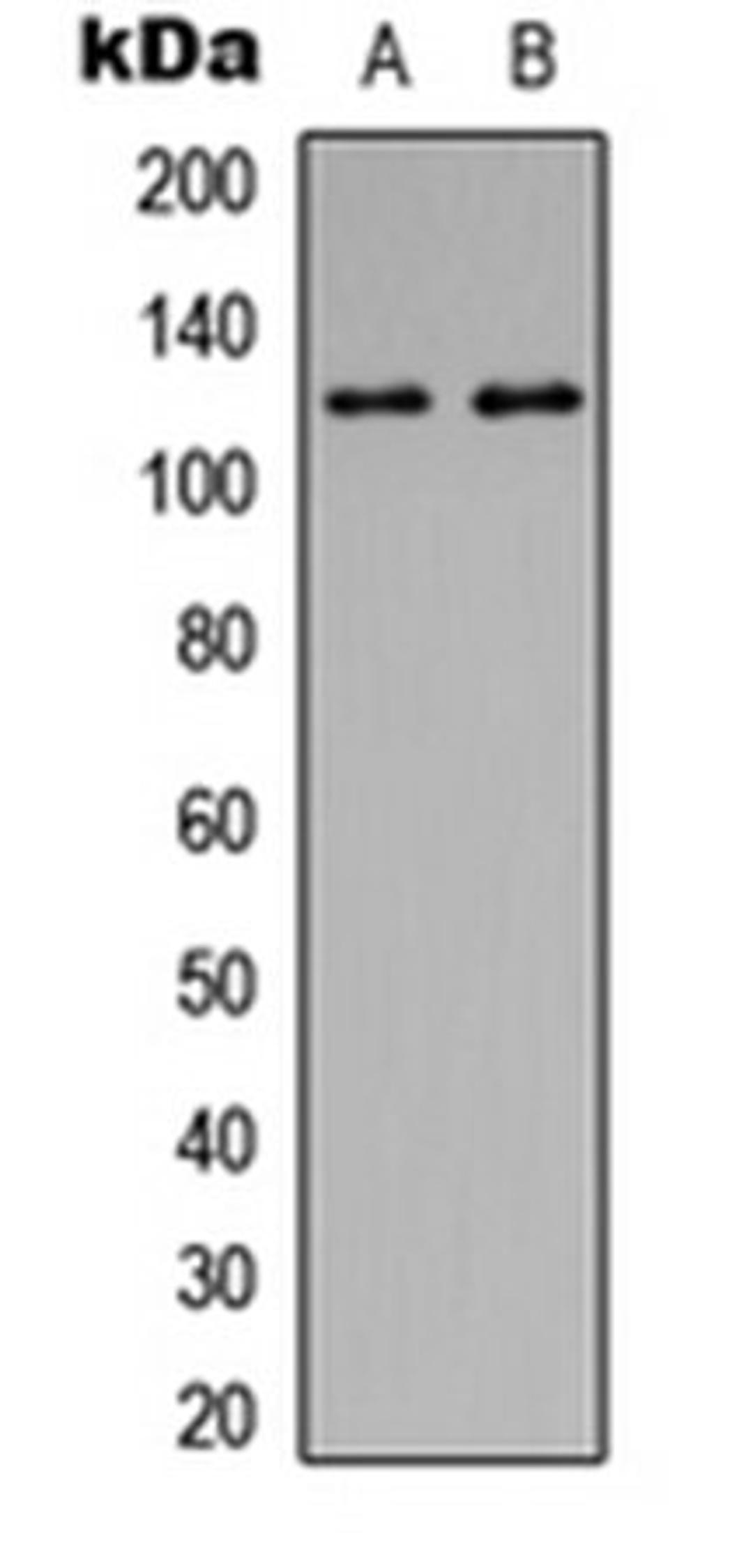 Western blot analysis of HEK293T (Lane 1), MDA-MB-231 (Lane 2) whole cell lysates using Focal Adhesion Kinase (phospho-Y397) antibody