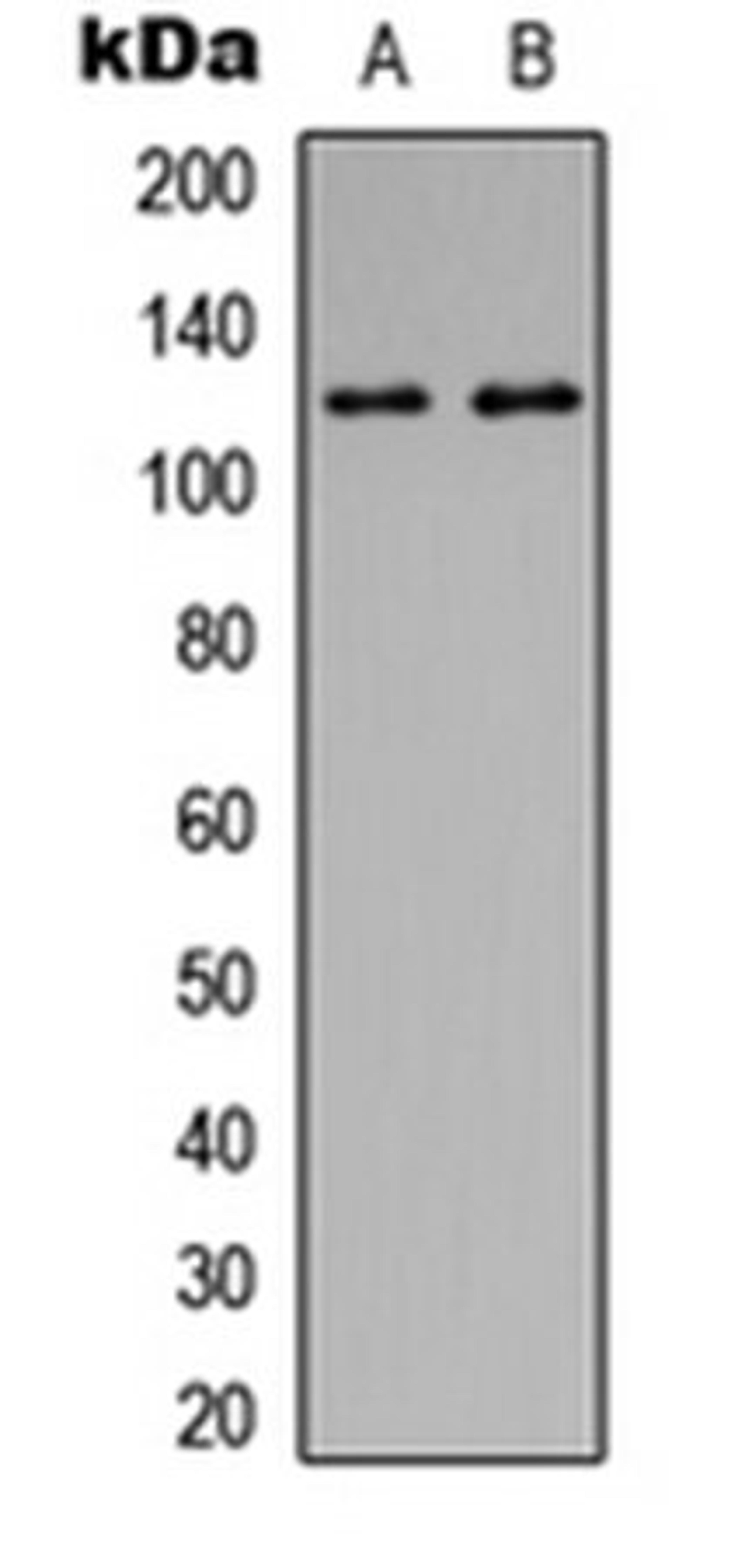 Western blot analysis of HEK293T (Lane 1), MDA-MB-231 (Lane 2) whole cell lysates using Focal Adhesion Kinase (phospho-Y397) antibody