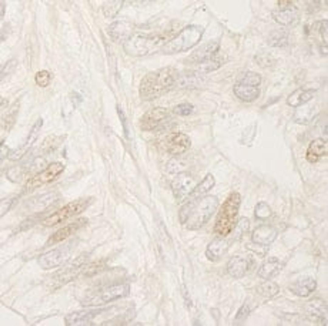 Detection of human APC by immunohistochemistry.