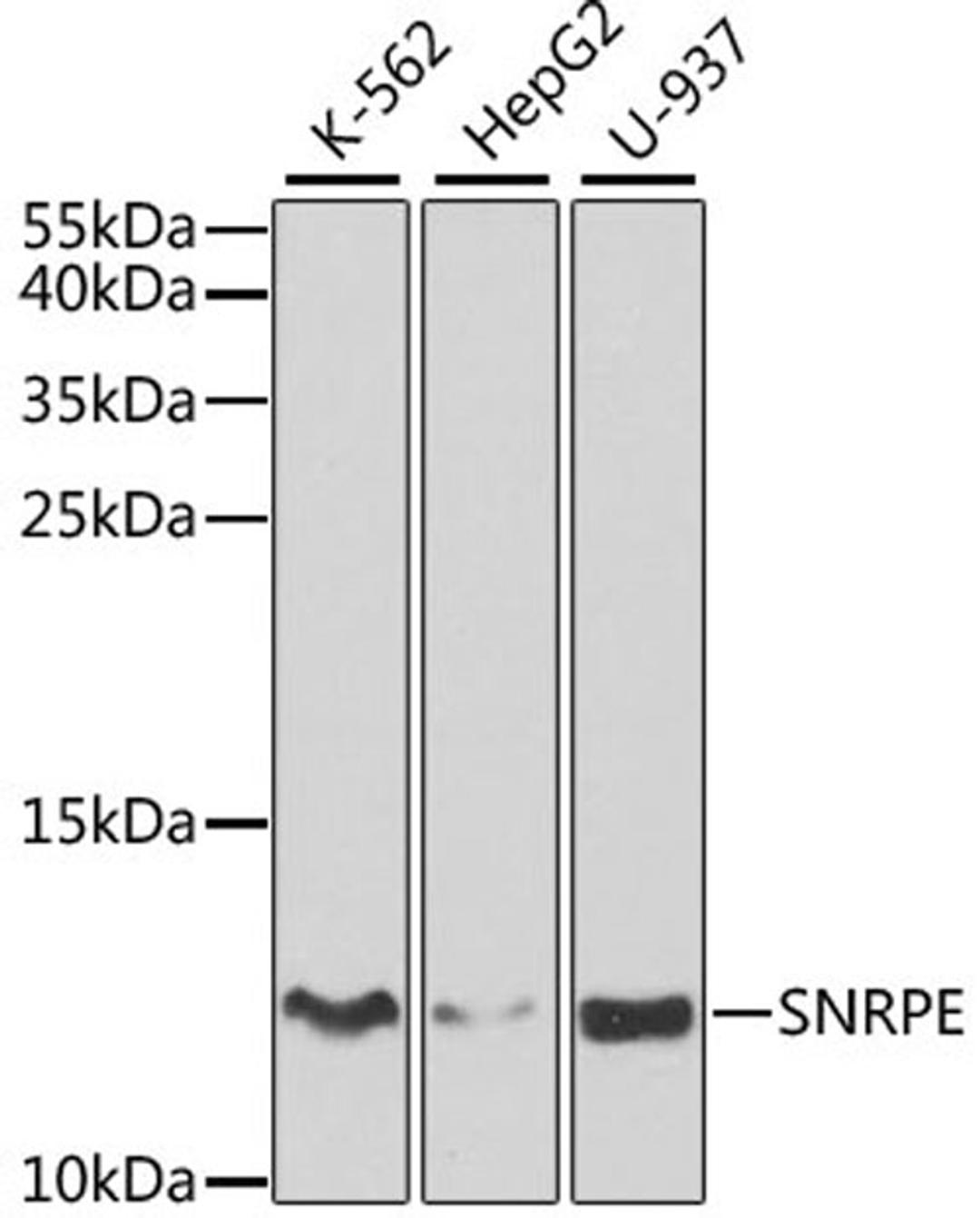 Western blot - SNRPE antibody (A5488)