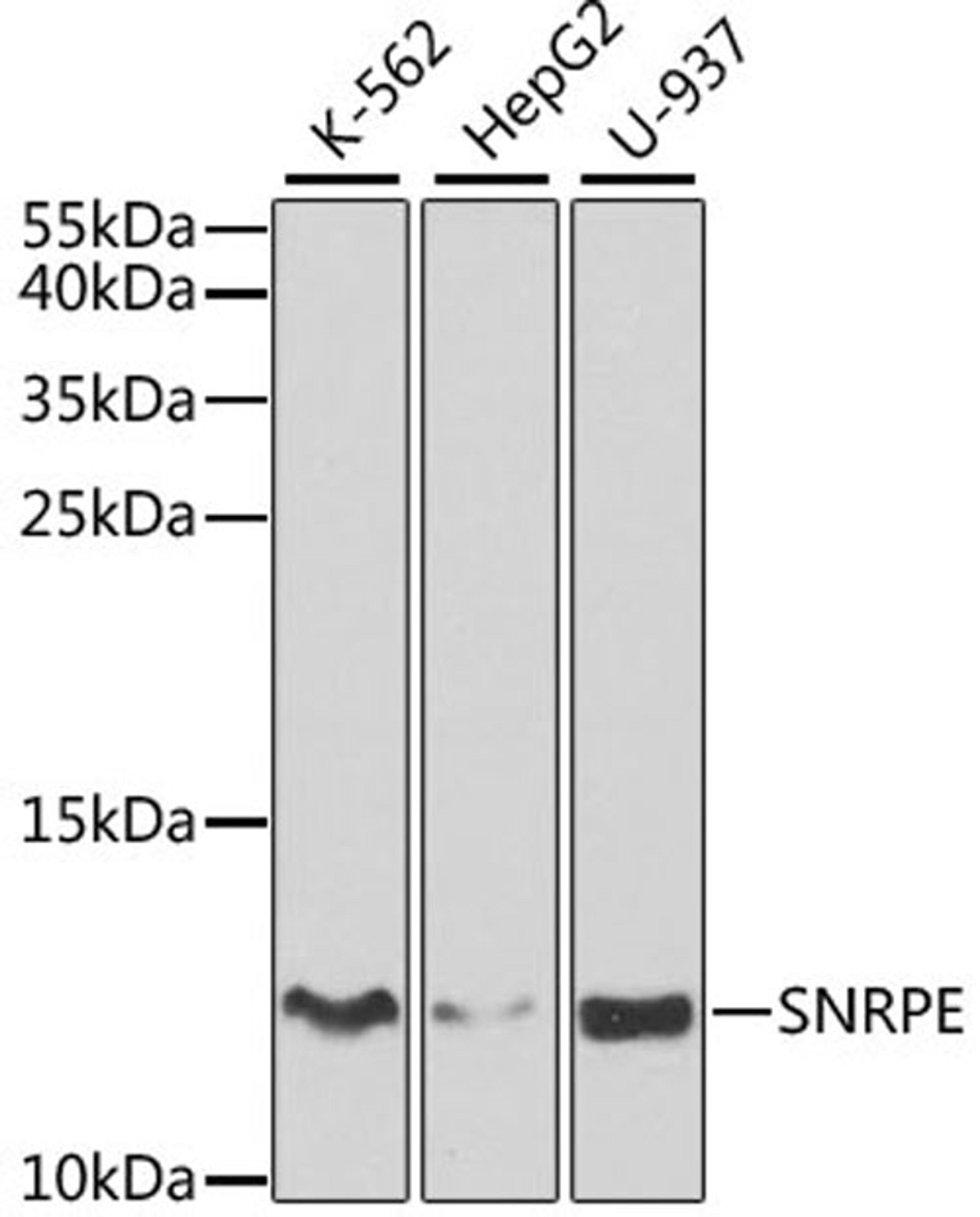 Western blot - SNRPE antibody (A5488)