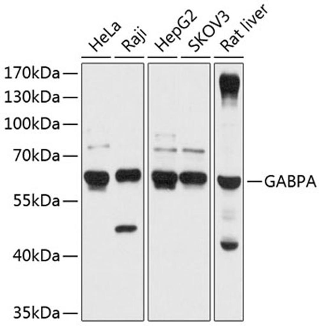 Western blot - GABPA antibody (A12047)