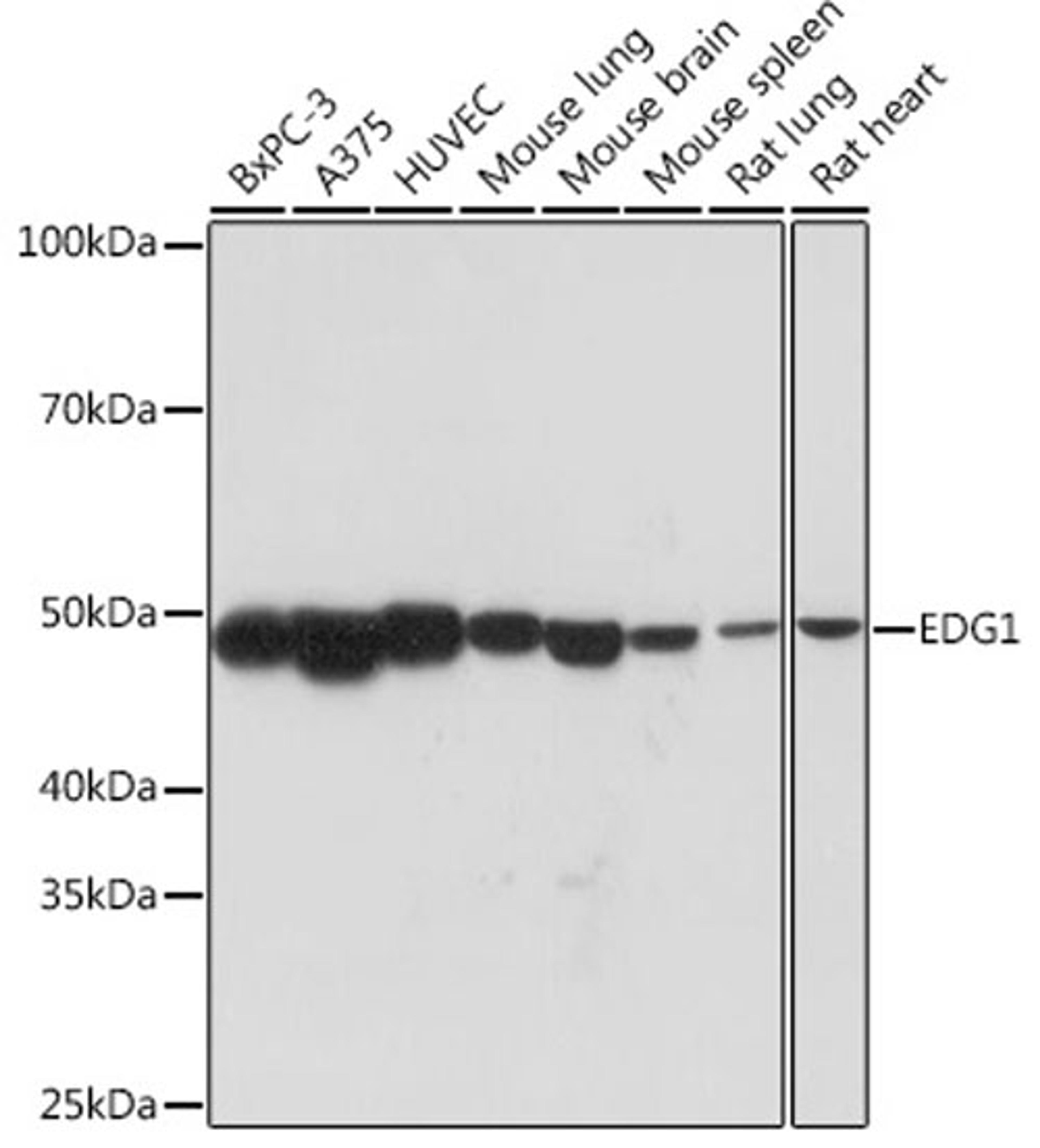 Western blot - EDG1 Rabbit mAb (A3997)