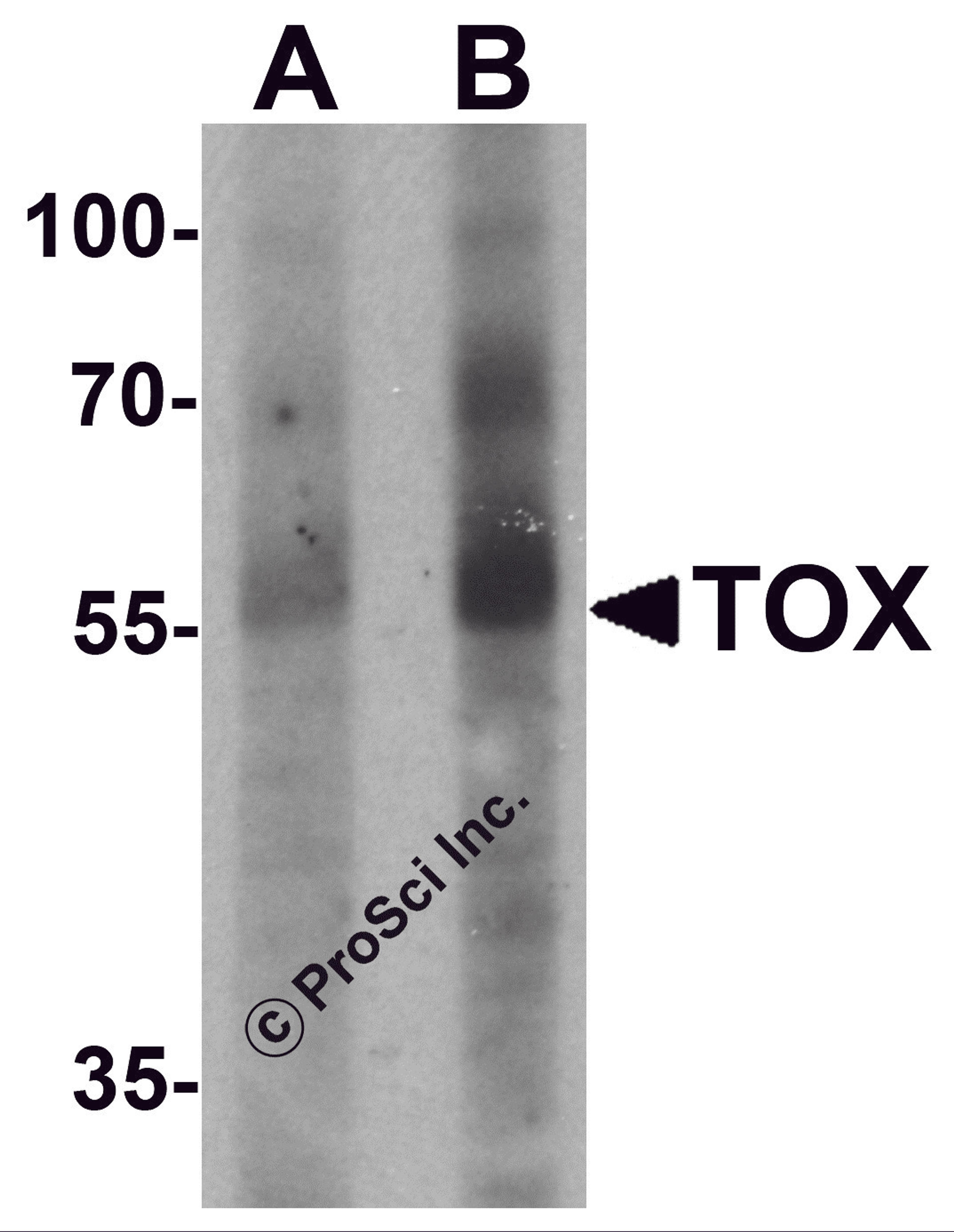 Western blot analysis of TOX in human colon tissue lysate with TOX antibody at (A) 1 and (B) 2 &#956;g/mL.