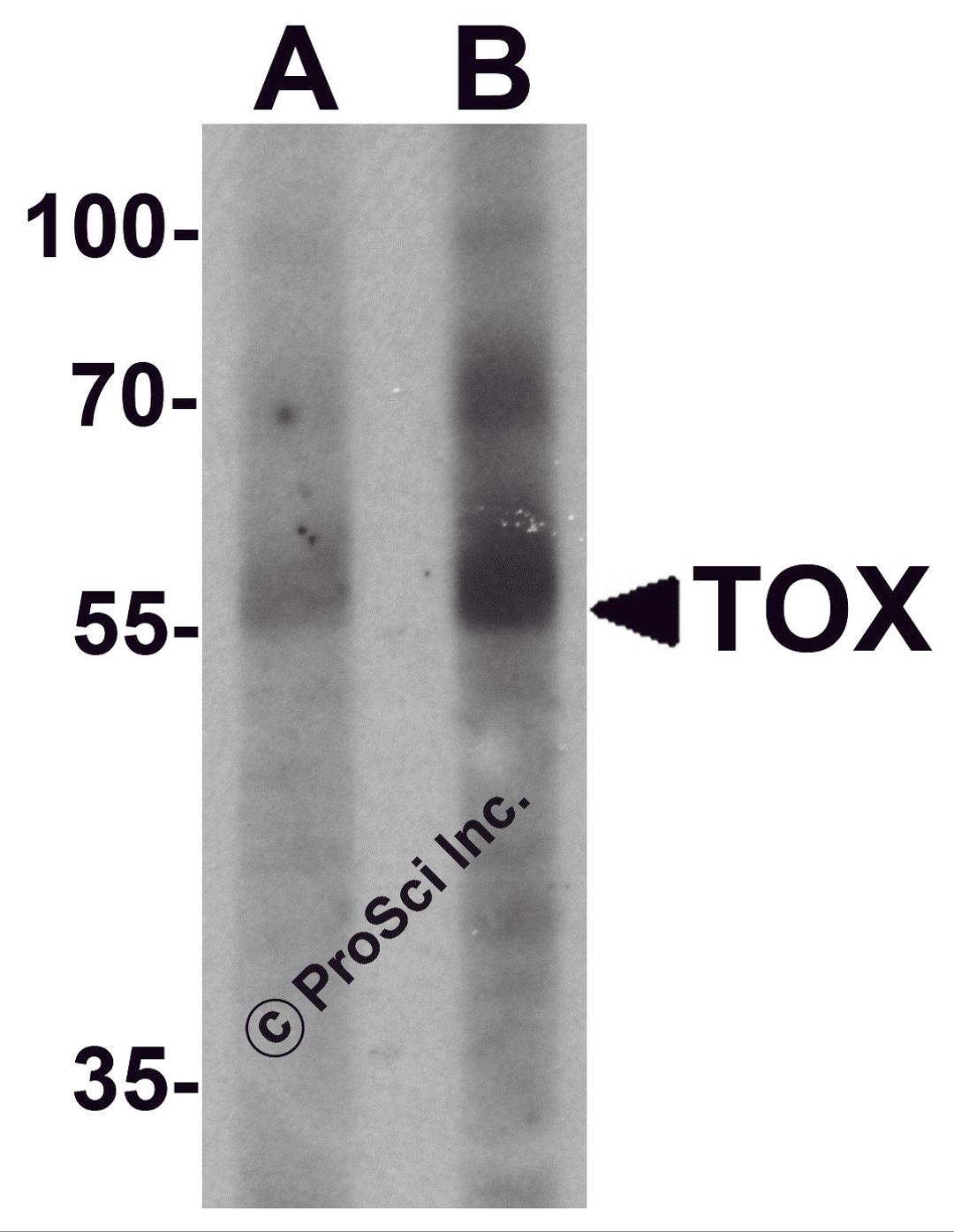 Western blot analysis of TOX in human colon tissue lysate with TOX antibody at (A) 1 and (B) 2 μg/mL.