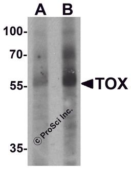 Western blot analysis of TOX in human colon tissue lysate with TOX antibody at (A) 1 and (B) 2 μg/mL.