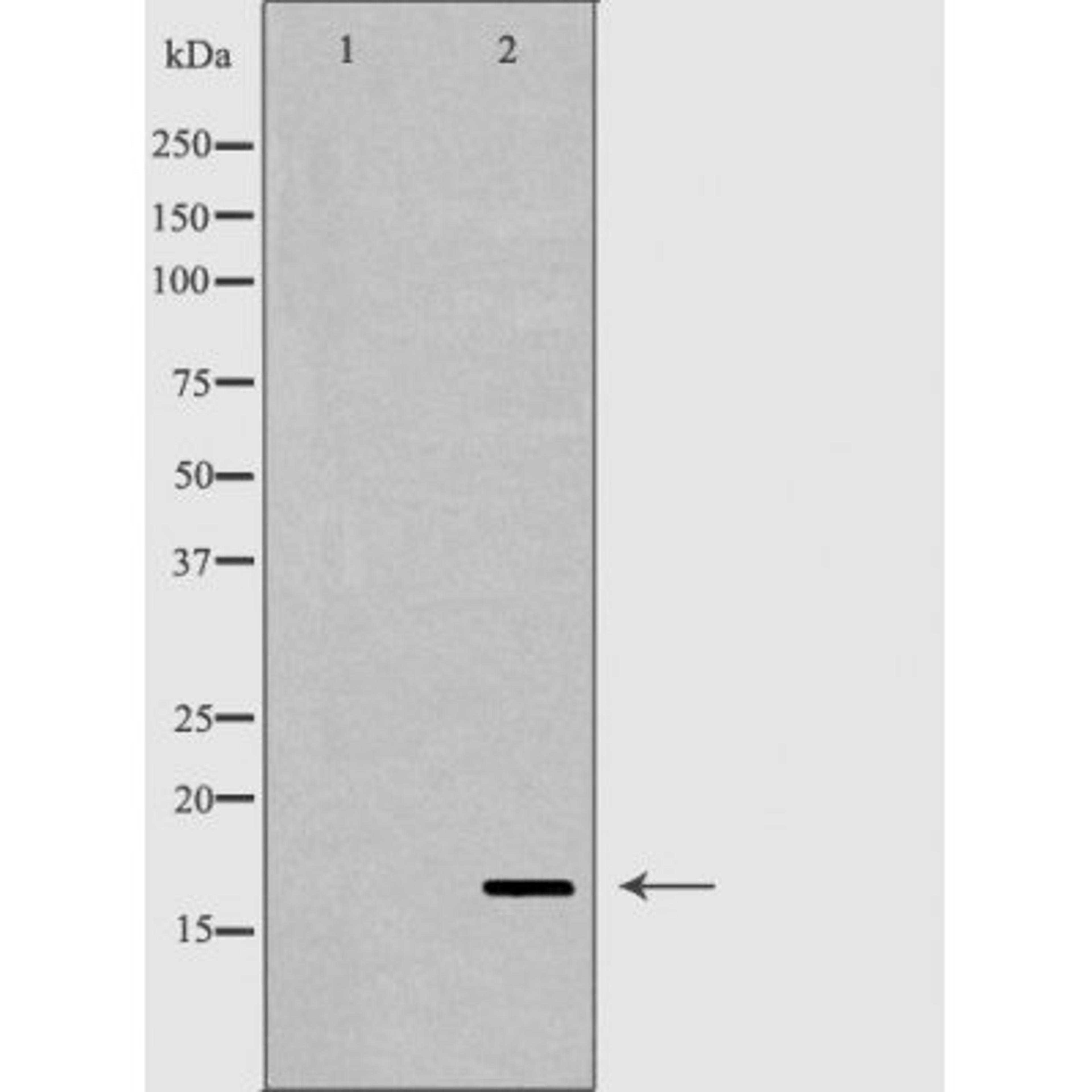 Western blot analysis of skin cell lysate using RNASE12 antibody