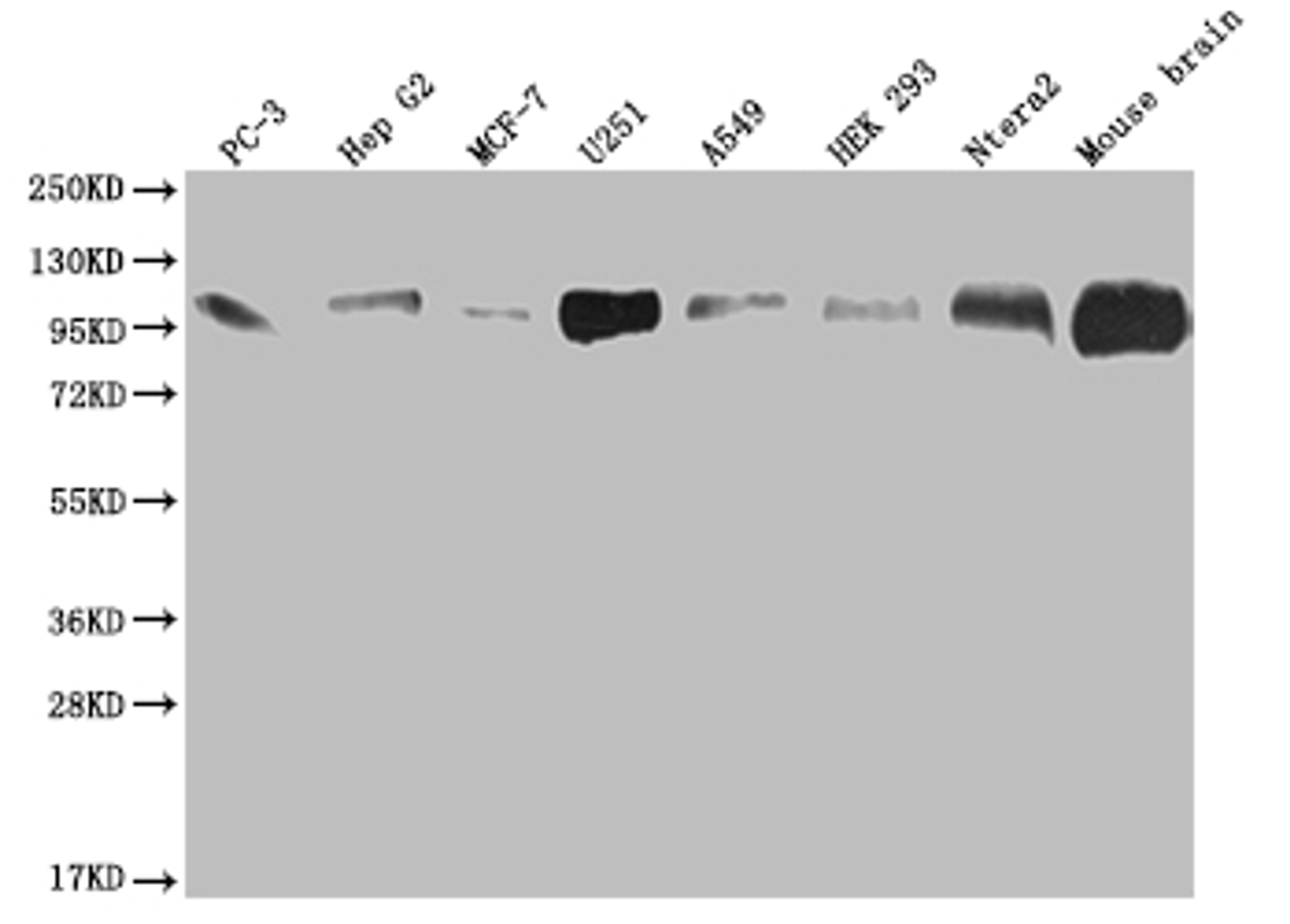 Western Blot. Positive WB detected in: PC3 whole cell lysate, HepG2 whole cell lysate, MCF-7 whole cell lysate, U251 whole cell lysate, A549 whole cell lysate, HEK293 whole cell lysate, Ntera-2 whole cell lysate, Mouse brain tissue. All lanes: ALCAM antibody at 1:2000. Secondary. Goat polyclonal to rabbit IgG at 1/50000 dilution. Predicted band size: 66, 64, 16, 34 kDa. Observed band size: 100 kDa.