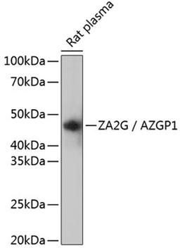 Western blot - ZA2G / AZGP1 Rabbit mAb (A11680)