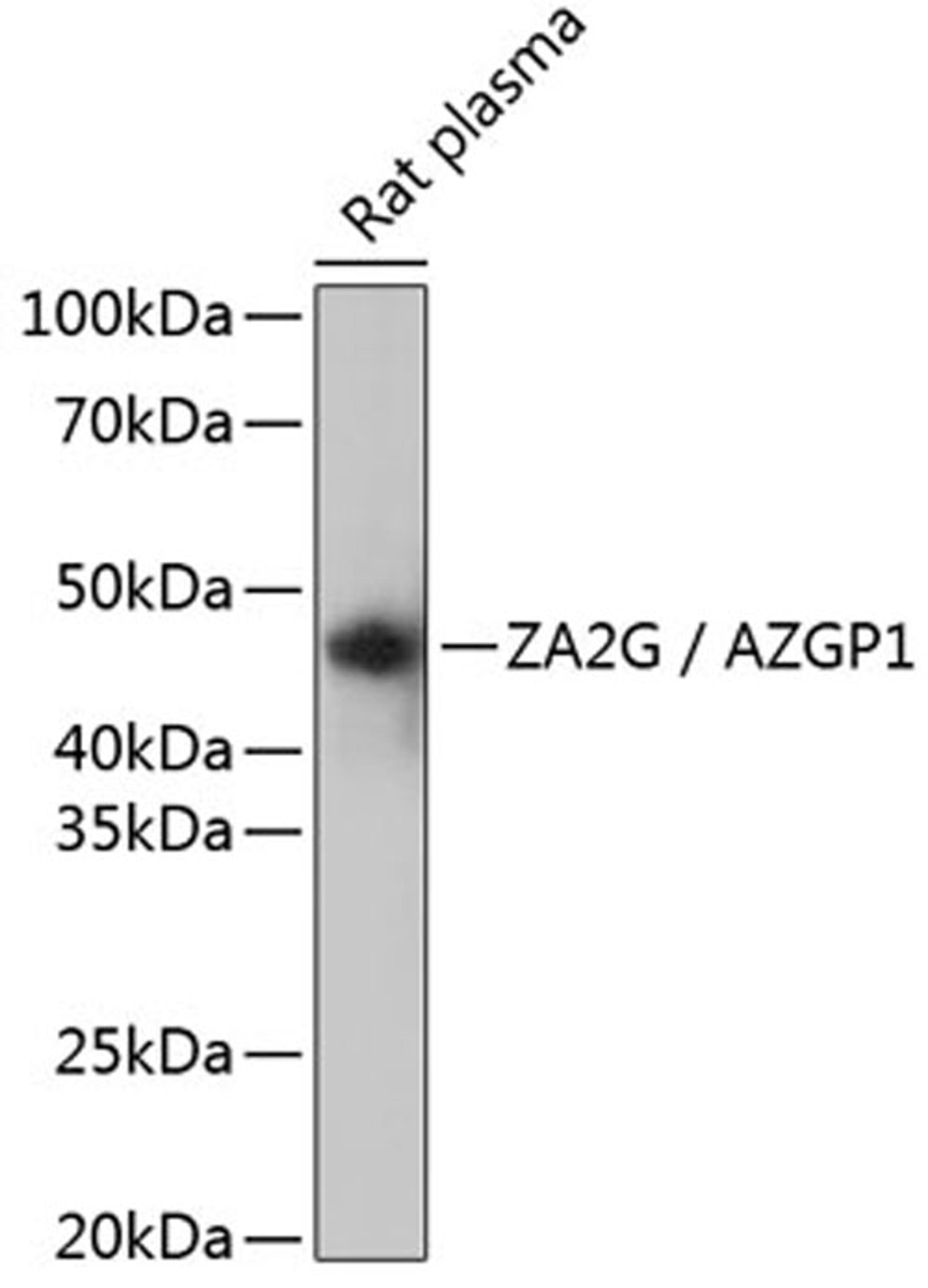 Western blot - ZA2G / AZGP1 Rabbit mAb (A11680)