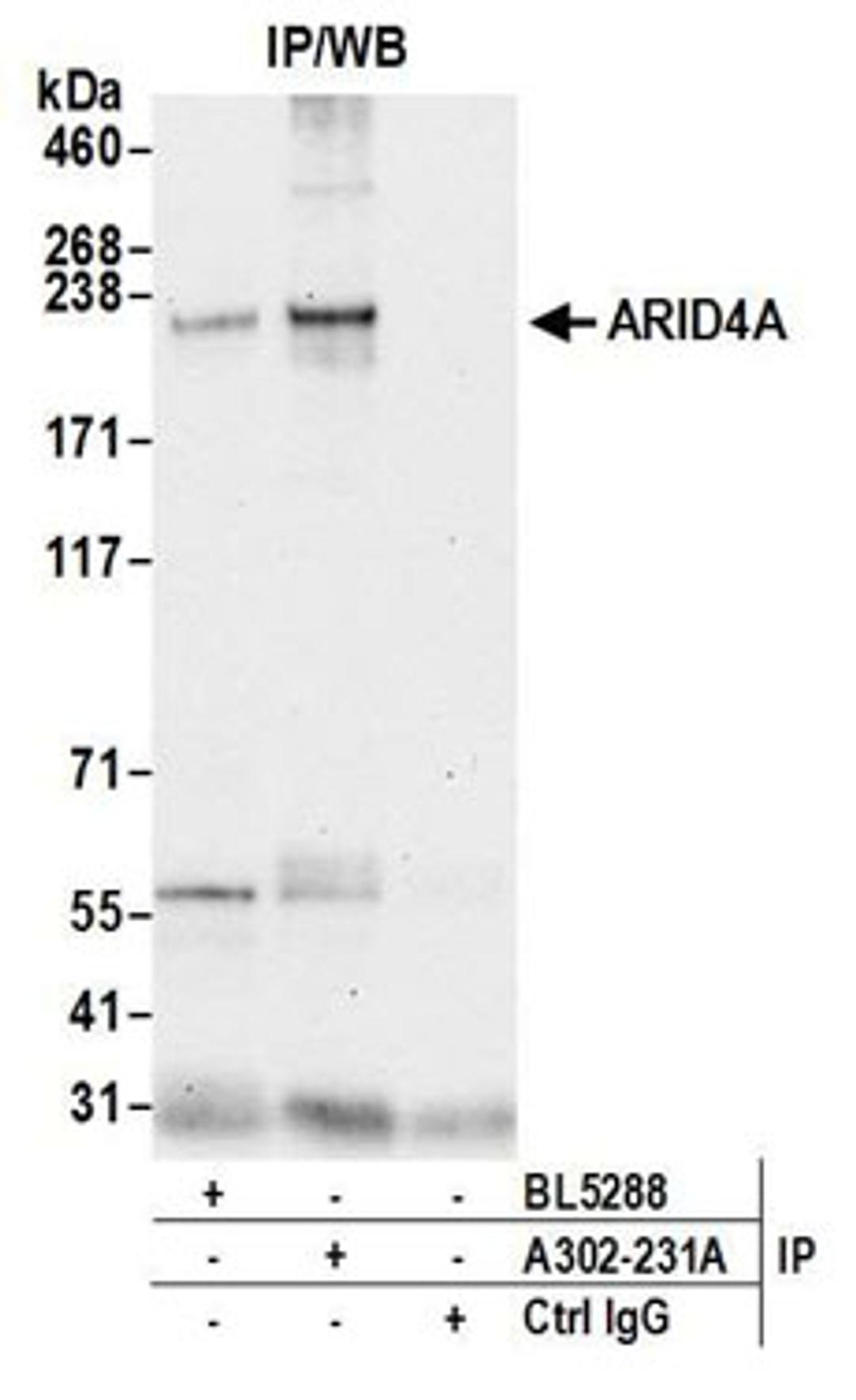 Detection of human ARID4A by western blot of immunoprecipitates.