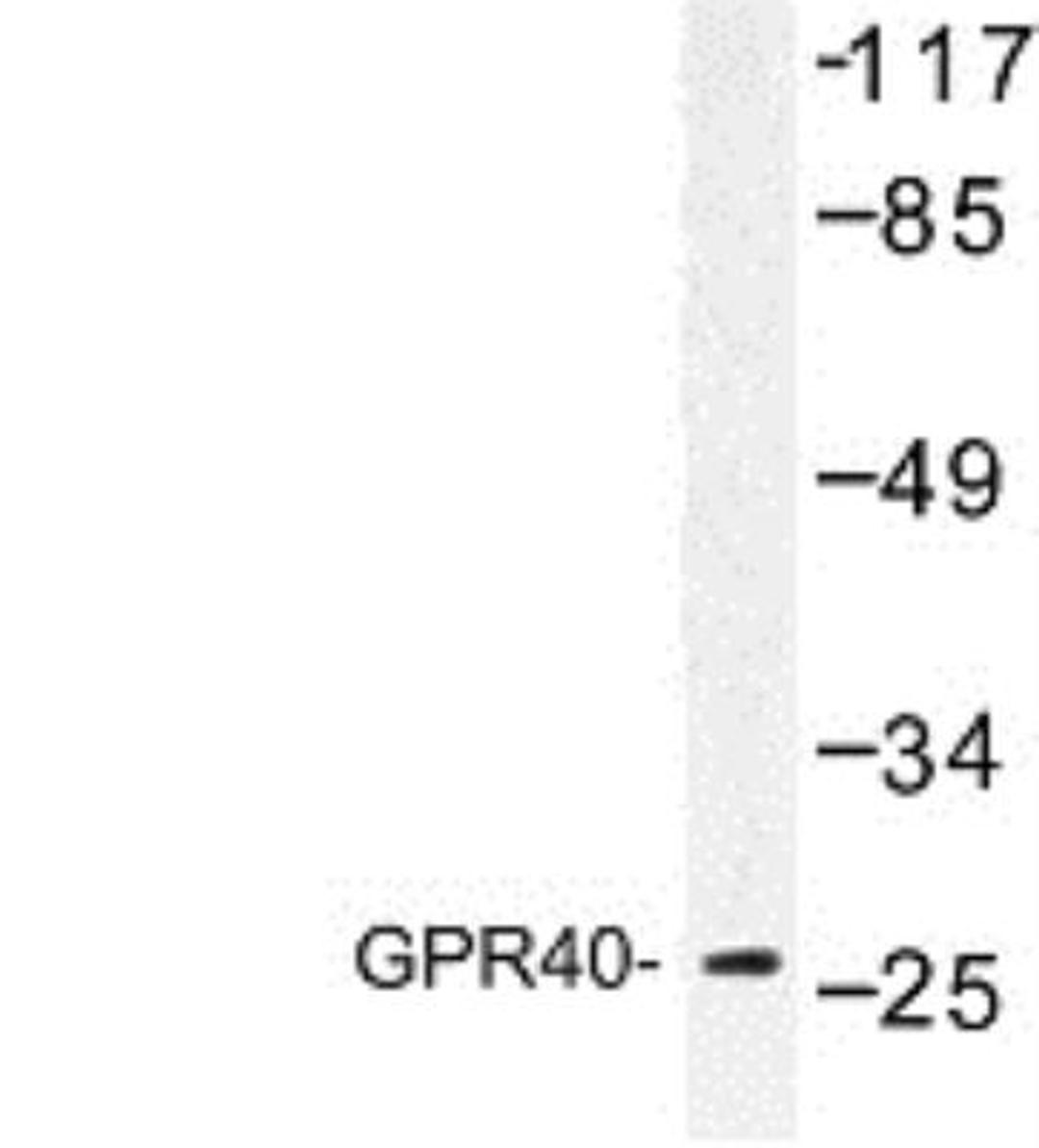 Western Blot: FFAR1/GPR40 Antibody [NBP1-00860] - Extracts from COS-7 cells treated with forskolin 40nM 30'