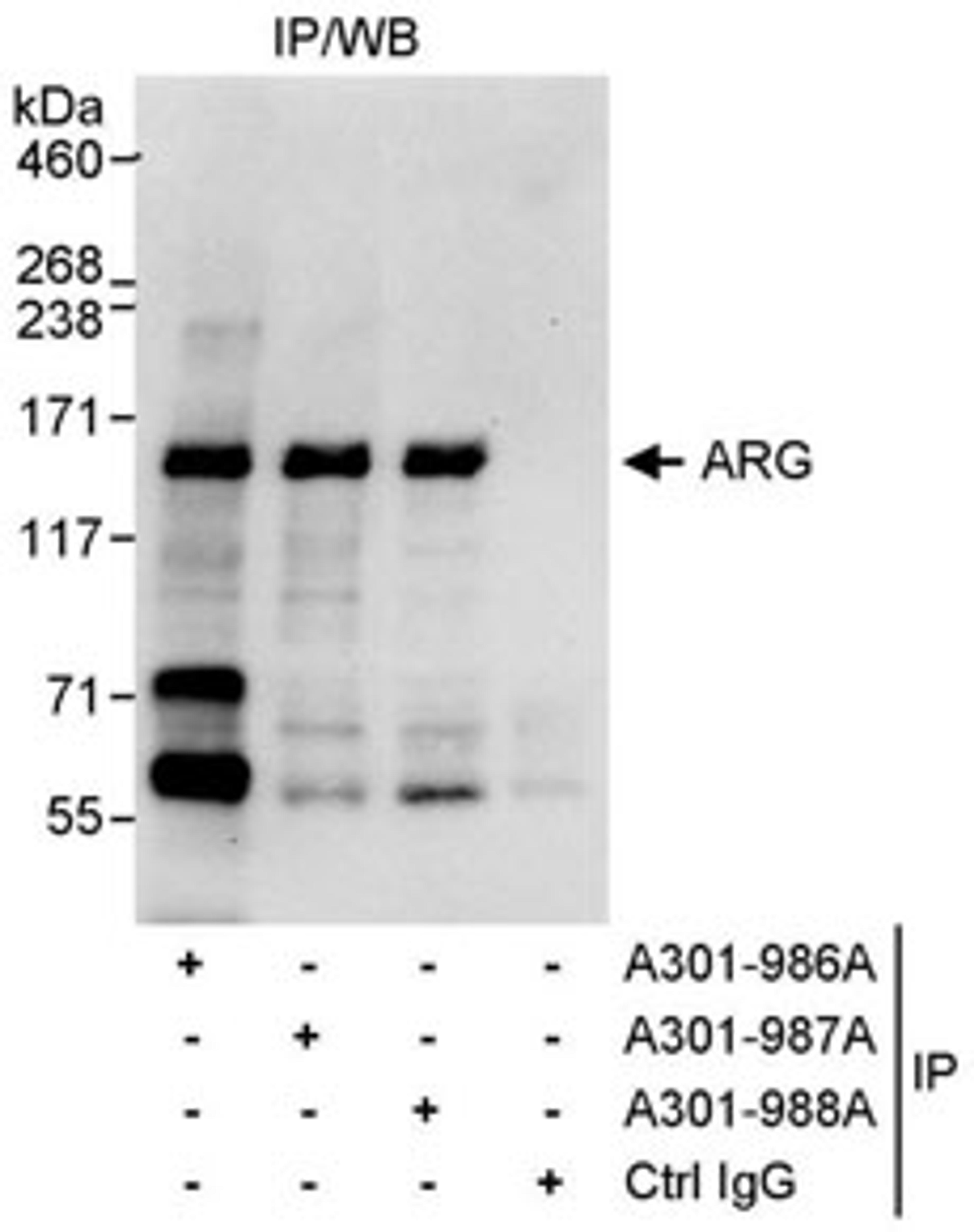 Detection of human ARG by western blot of immunoprecipitates.