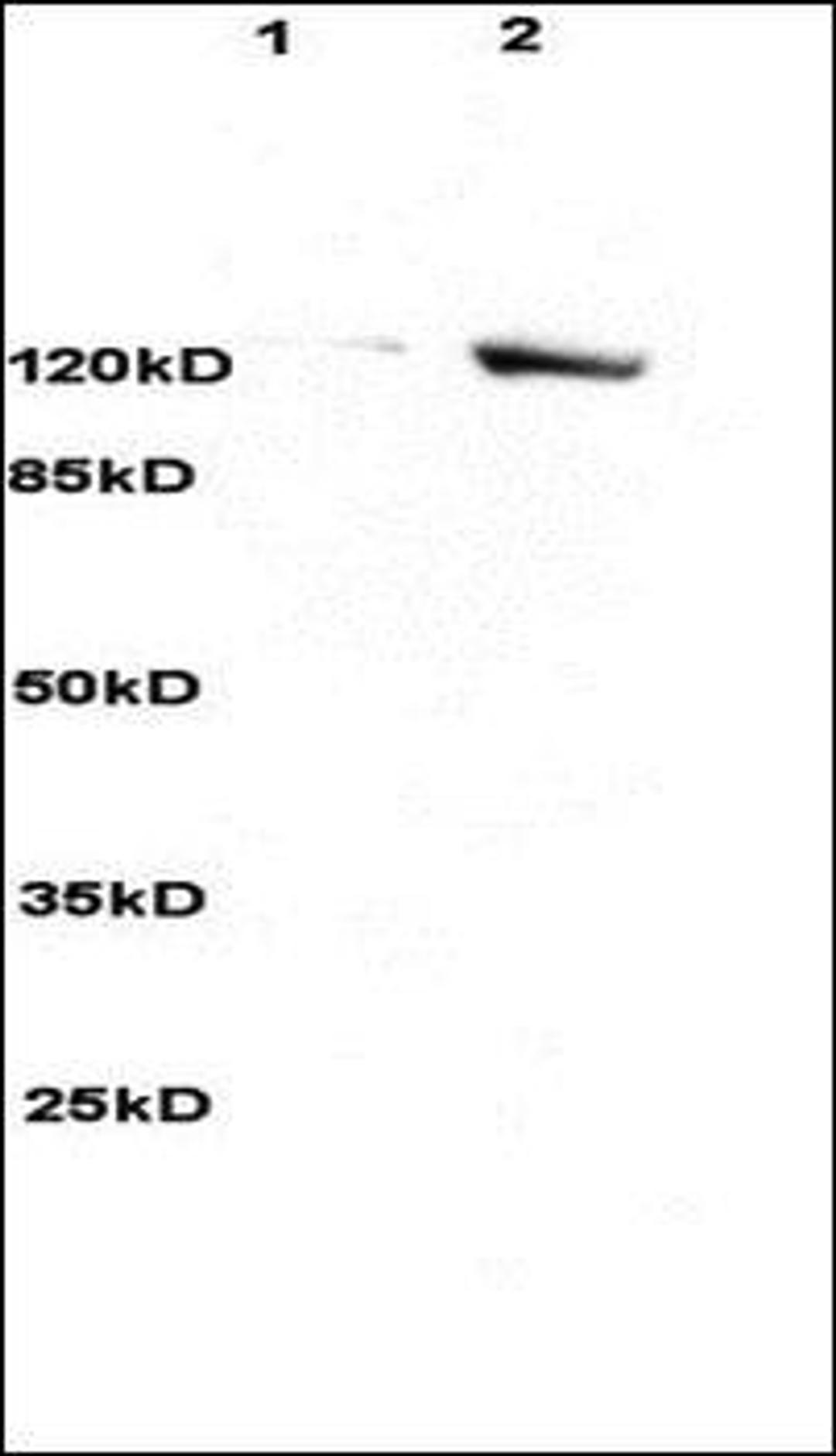 Western blot analysis of rat brain lysates (Lane1), human colon carcinoma lysates (Lane2) dilution at:1:3000 using SREBP2 antibody