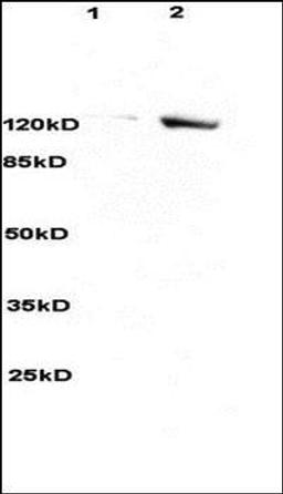 Western blot analysis of rat brain lysates (Lane1), human colon carcinoma lysates (Lane2) dilution at:1:3000 using SREBP2 antibody