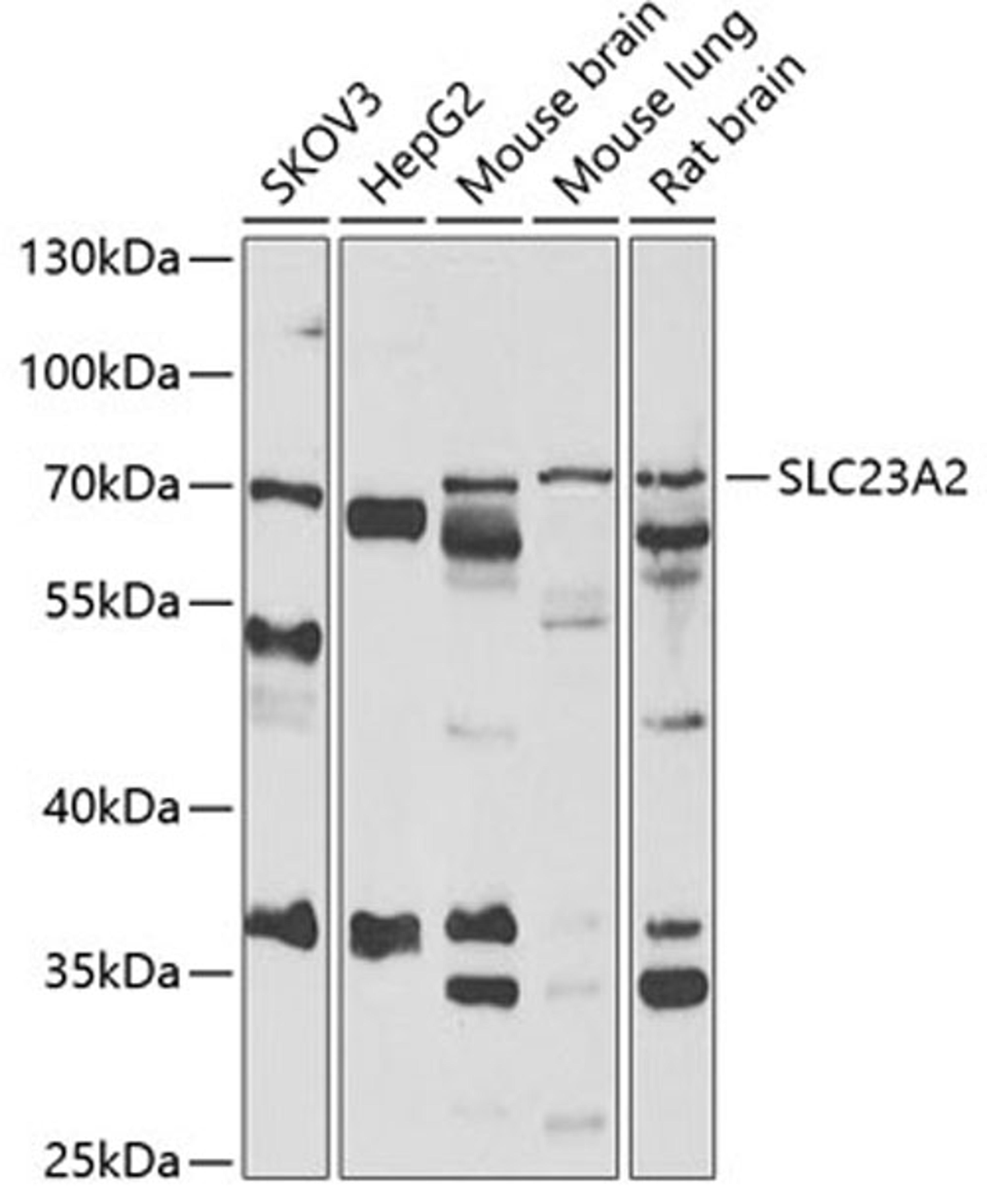 Western blot - SLC23A2 antibody (A6740)