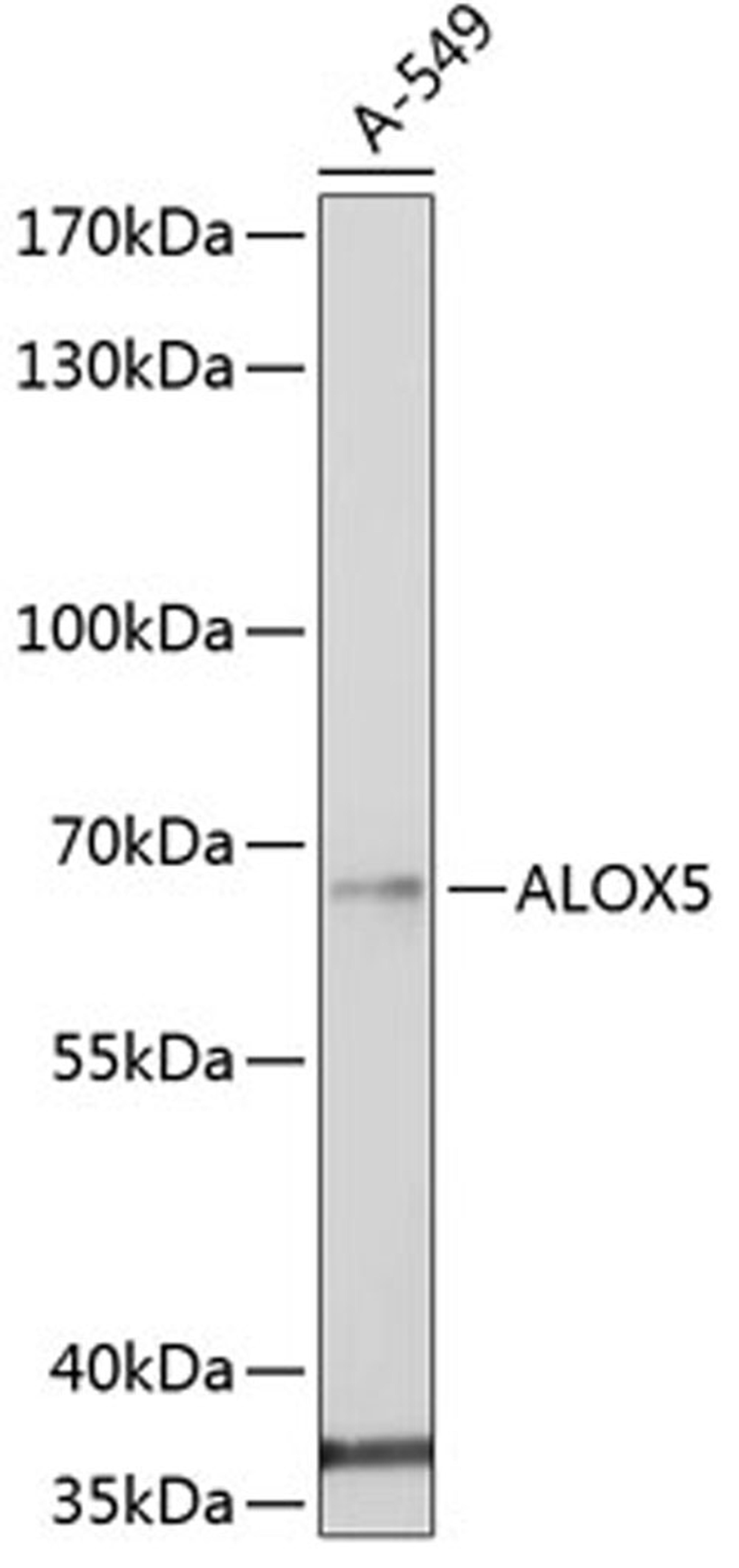 Western blot - ALOX5 antibody (A2158)