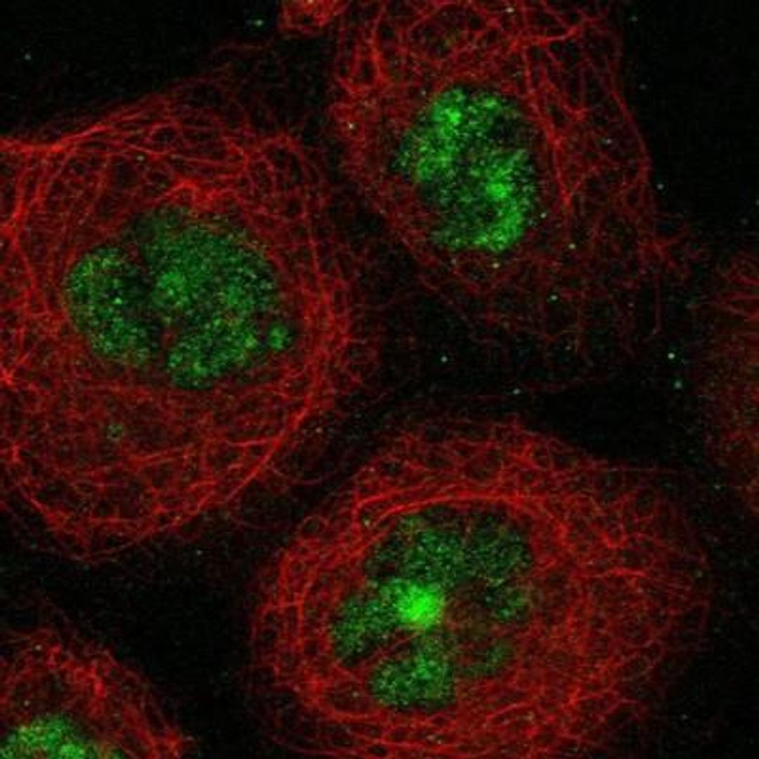 Immunocytochemistry/Immunofluorescence: SGOL2 Antibody [NBP1-83567] - Staining of human cell line A-431 shows positivity in nucleus but not nucleoli.