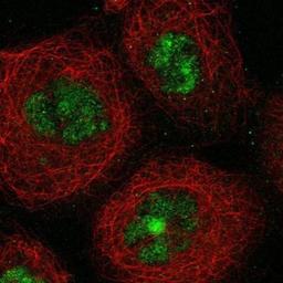 Immunocytochemistry/Immunofluorescence: SGOL2 Antibody [NBP1-83567] - Staining of human cell line A-431 shows positivity in nucleus but not nucleoli.