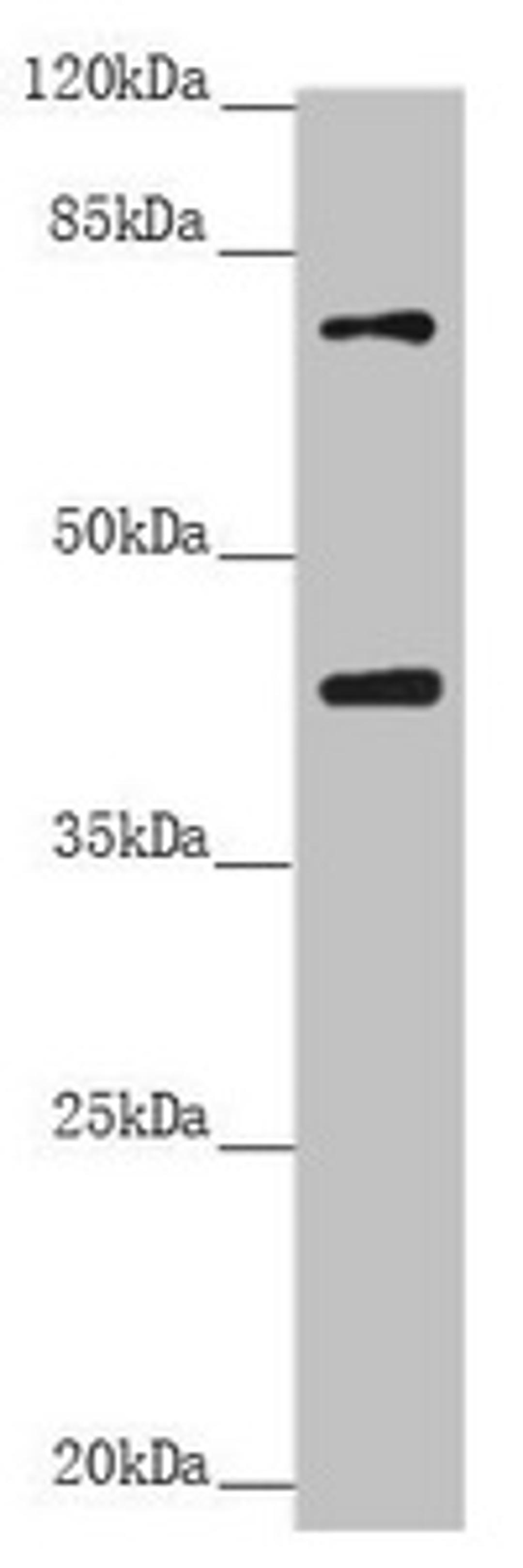 Western blot. All lanes: RACGAP1 antibody at 2.68 ug/ml. + Raji whole cell lysate. Secondary. Goat polyclonal to rabbit IgG at 1/10000 dilution. Predicted band size: 71 kDa. Observed band size: 71, 40 kDa.