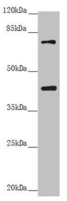 Western blot. All lanes: RACGAP1 antibody at 2.68 ug/ml. + Raji whole cell lysate. Secondary. Goat polyclonal to rabbit IgG at 1/10000 dilution. Predicted band size: 71 kDa. Observed band size: 71, 40 kDa.