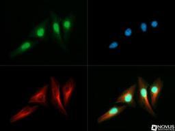 Immunocytochemistry/Immunofluorescence: RTEL1 Antibody [NBP2-22360] - RTEL1 antibody was tested in Hela cells with DyLight 488 (green). Nuclei and alpha-tubulin were counterstained with DAPI (blue) and Dylight 550 (red).