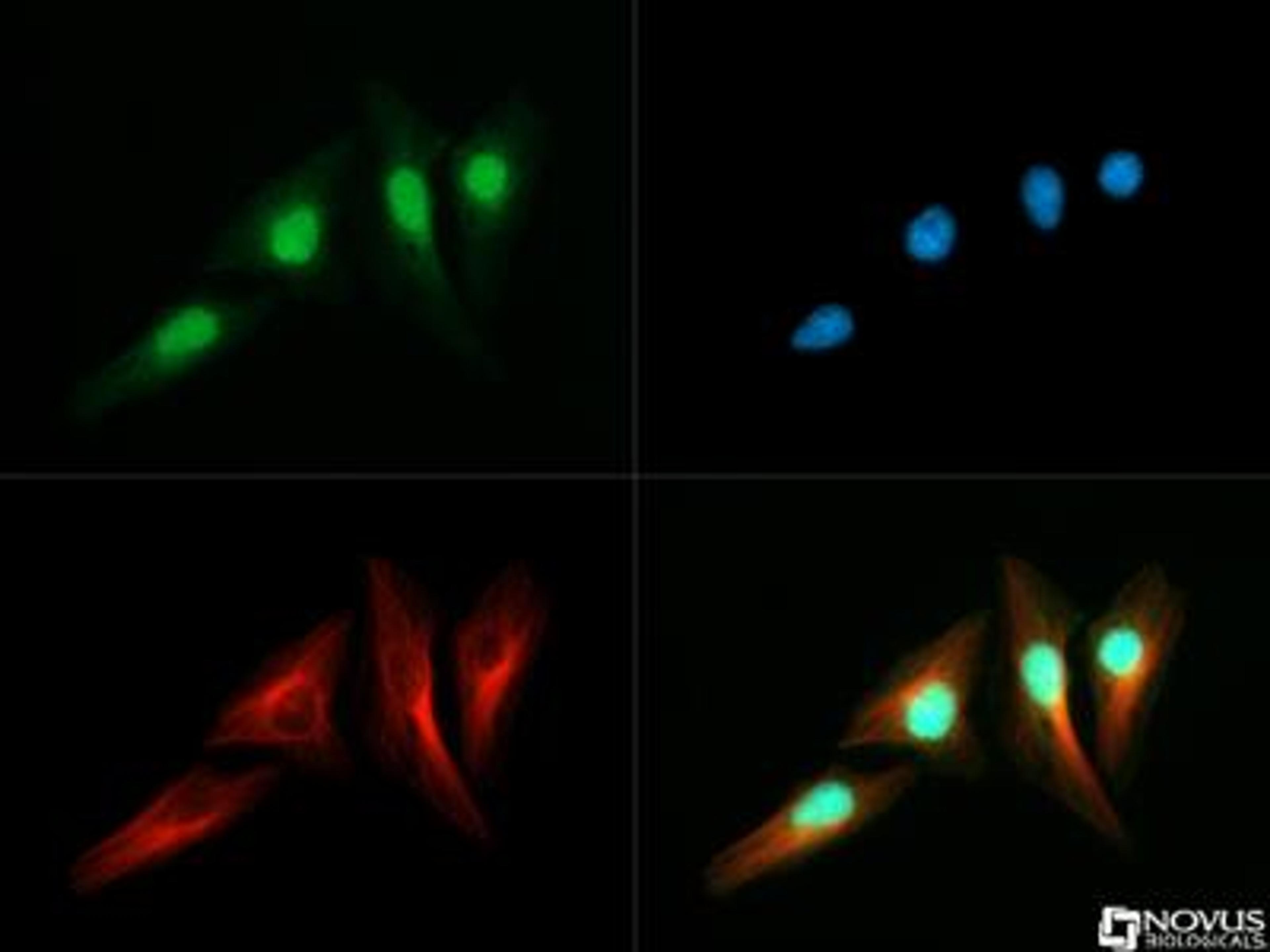 Immunocytochemistry/Immunofluorescence: RTEL1 Antibody [NBP2-22360] - RTEL1 antibody was tested in Hela cells with DyLight 488 (green). Nuclei and alpha-tubulin were counterstained with DAPI (blue) and Dylight 550 (red).