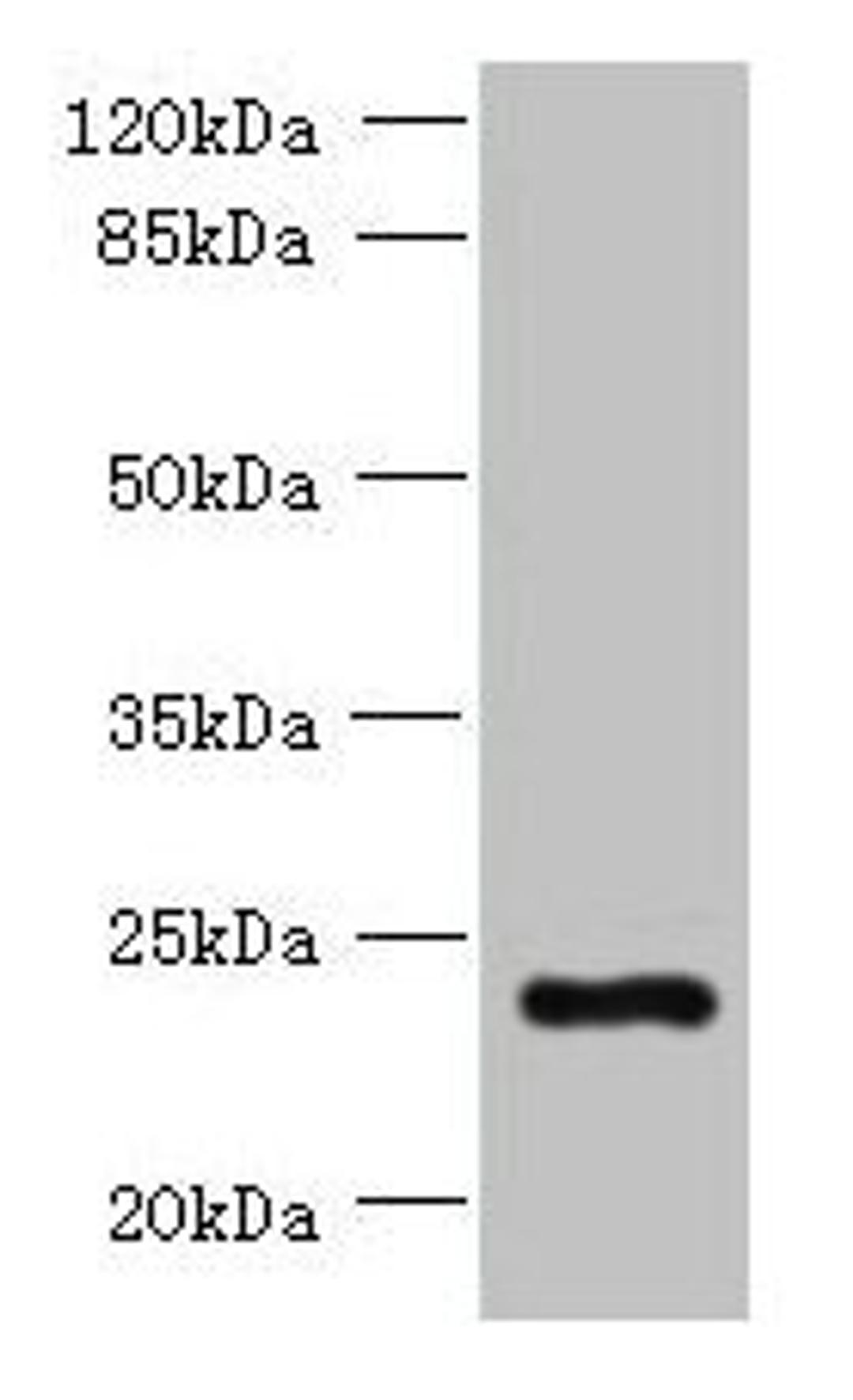 Western blot. All lanes: PQLC3 antibody at 3µg/ml + Mouse liver tissue. Secondary. Goat polyclonal to rabbit IgG at 1/10000 dilution. Predicted band size: 23, 21 kDa. Observed band size: 23 kDa