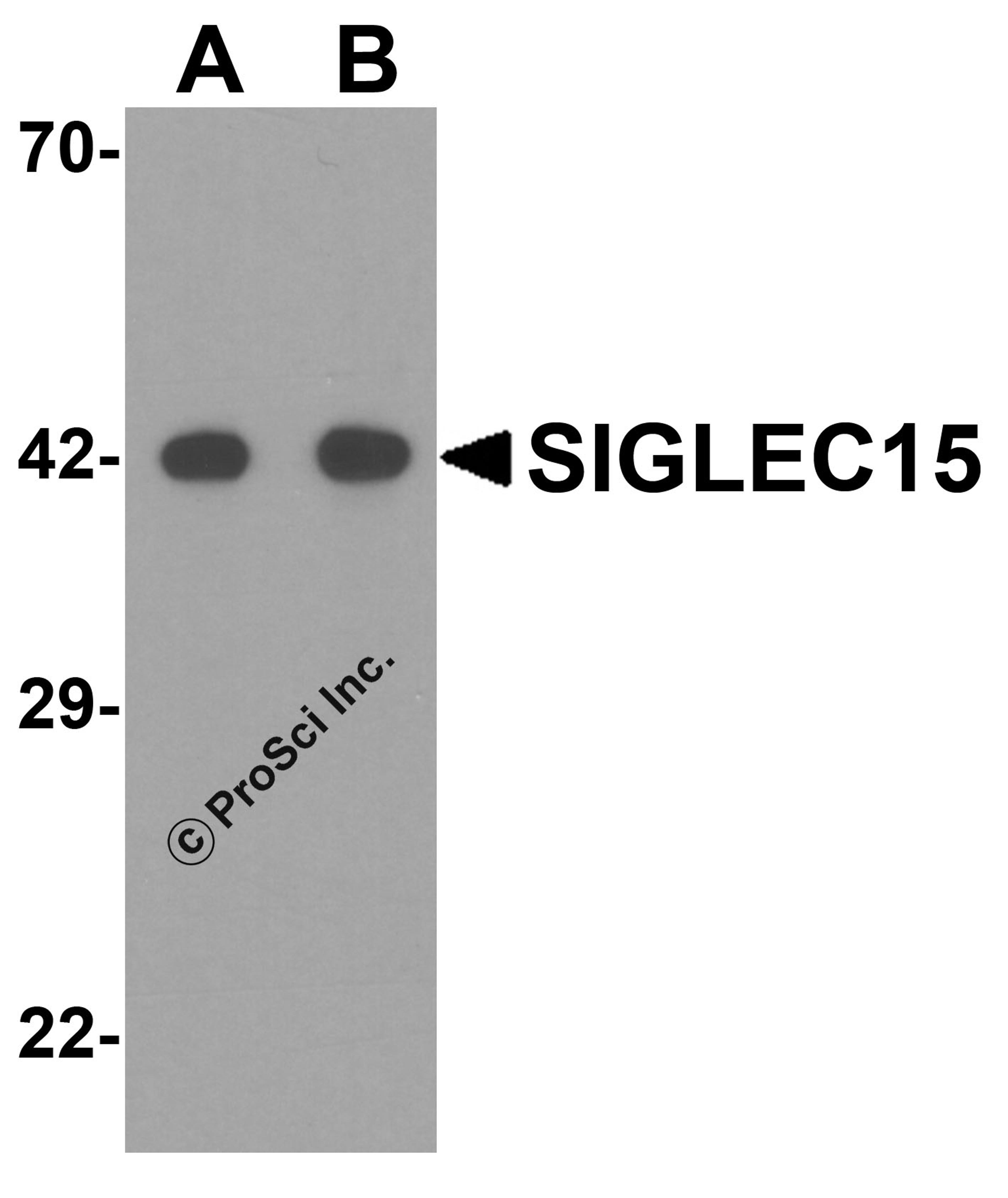 Western blot analysis of SIGLEC15 in human kidney tissue lysate with SIGLEC15 antibody at (A) 1 and (B) 2 μg/mL.