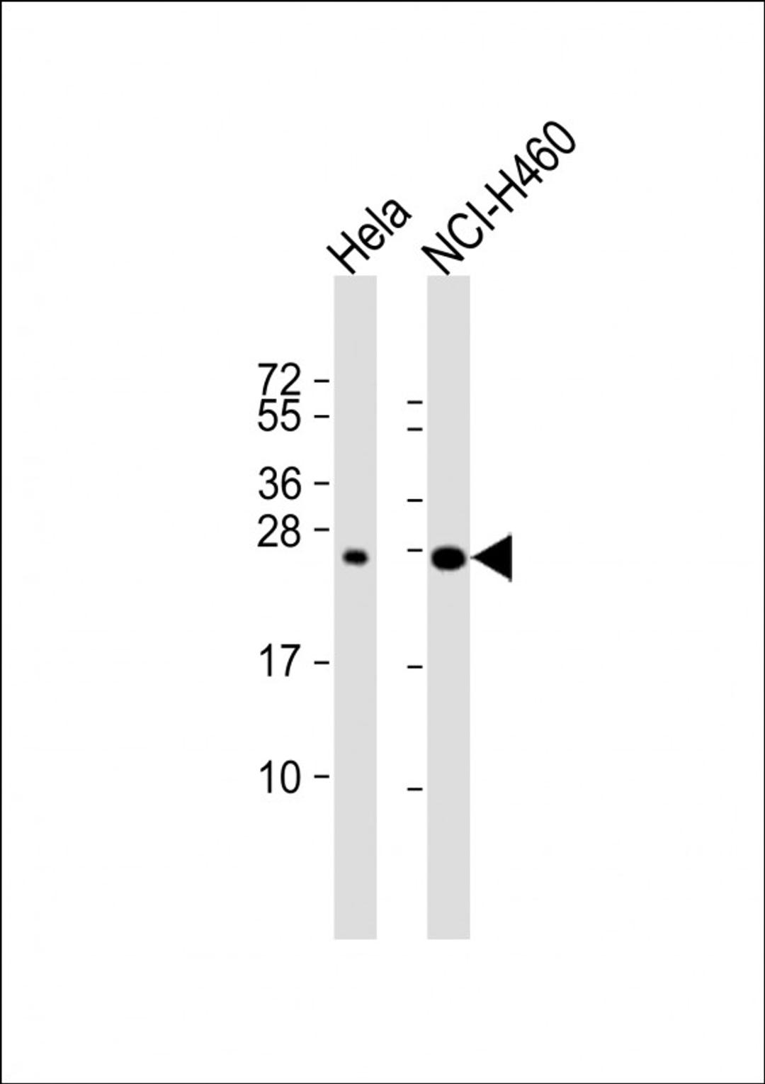 Western Blot at 1:1000 dilution Lane 1: Hela whole cell lysate Lane 2: NCI-H460 whole cell lysate Lysates/proteins at 20 ug per lane.