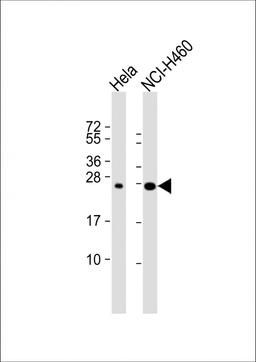 Western Blot at 1:1000 dilution Lane 1: Hela whole cell lysate Lane 2: NCI-H460 whole cell lysate Lysates/proteins at 20 ug per lane.