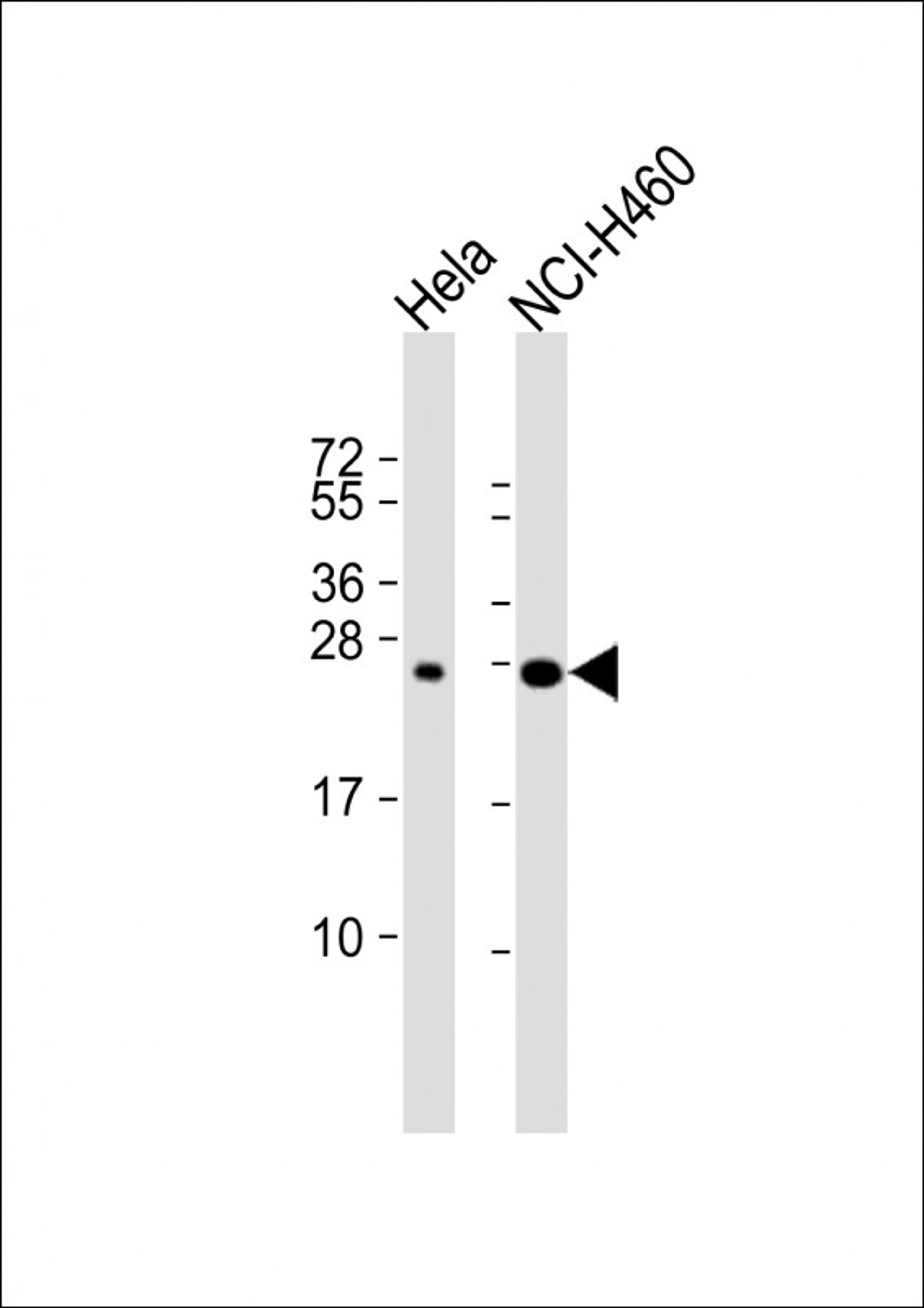 Western Blot at 1:1000 dilution Lane 1: Hela whole cell lysate Lane 2: NCI-H460 whole cell lysate Lysates/proteins at 20 ug per lane.