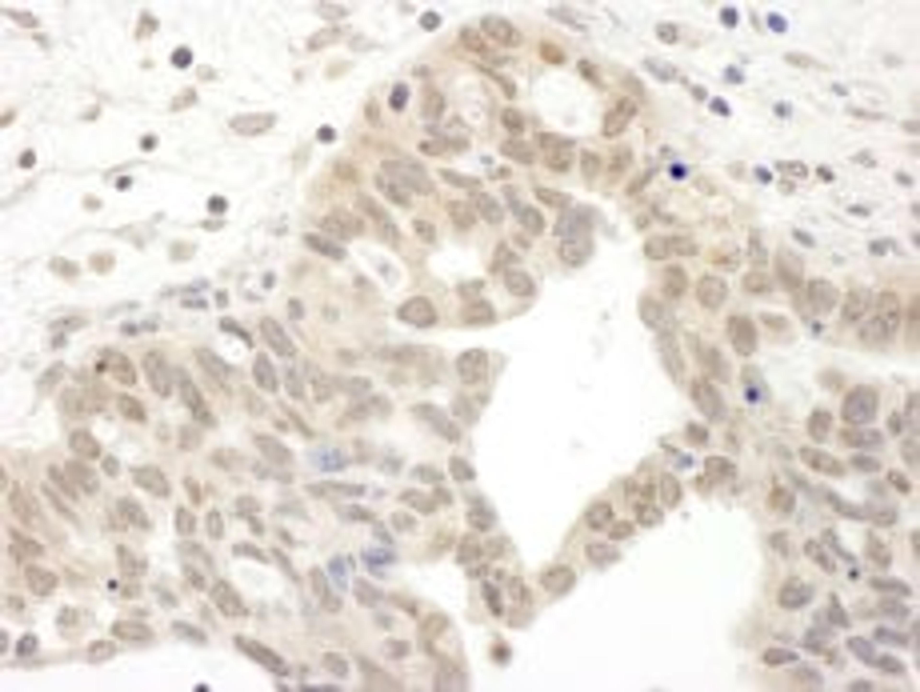 Detection of human JAK2 by immunohistochemistry.