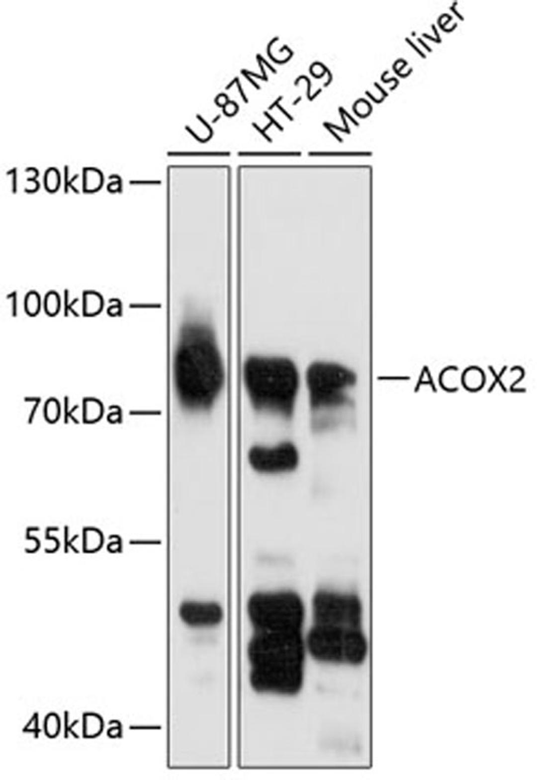 Western blot - ACOX2 antibody (A12796)