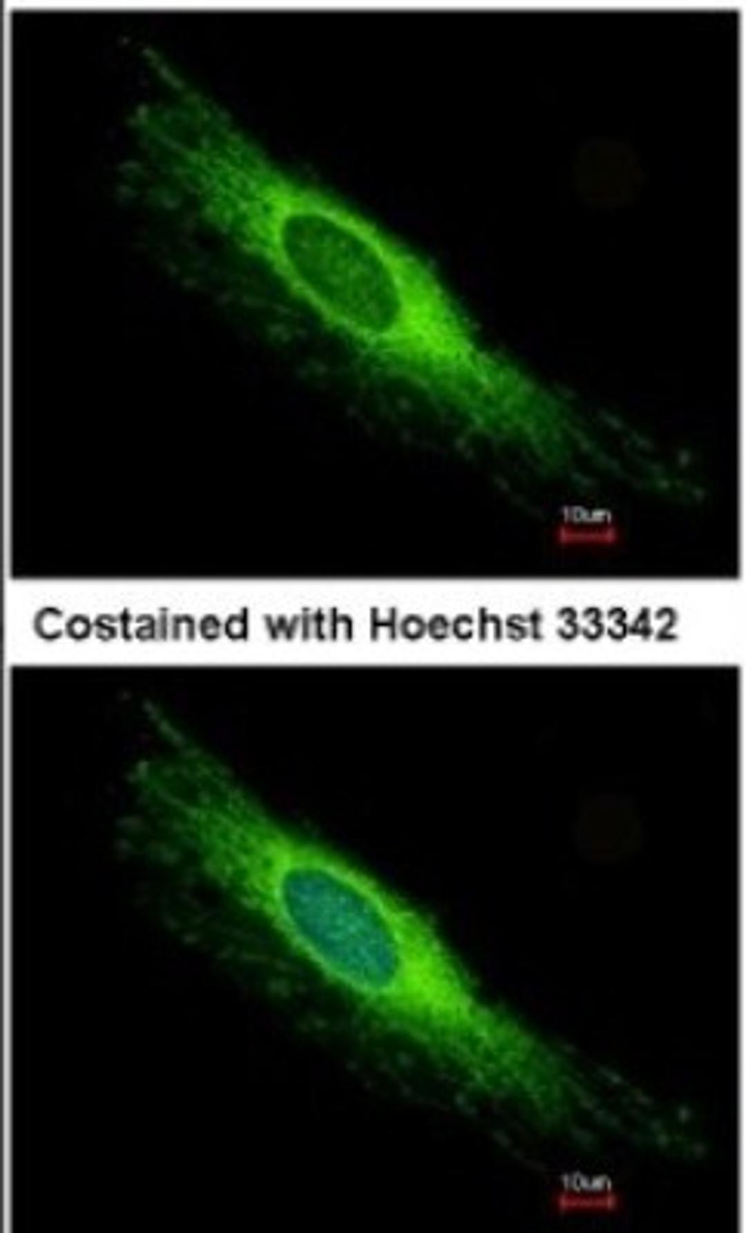 Immunocytochemistry/Immunofluorescence: PEX26 Antibody [NBP1-32743] - Analysis of methanol-fixed HeLa, using antibody at 1:500 dilution.