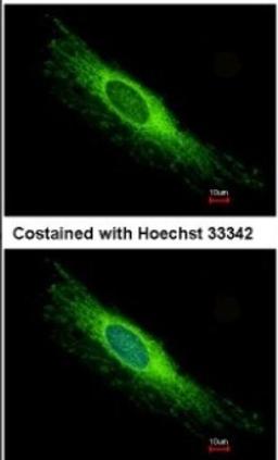 Immunocytochemistry/Immunofluorescence: PEX26 Antibody [NBP1-32743] - Analysis of methanol-fixed HeLa, using antibody at 1:500 dilution.