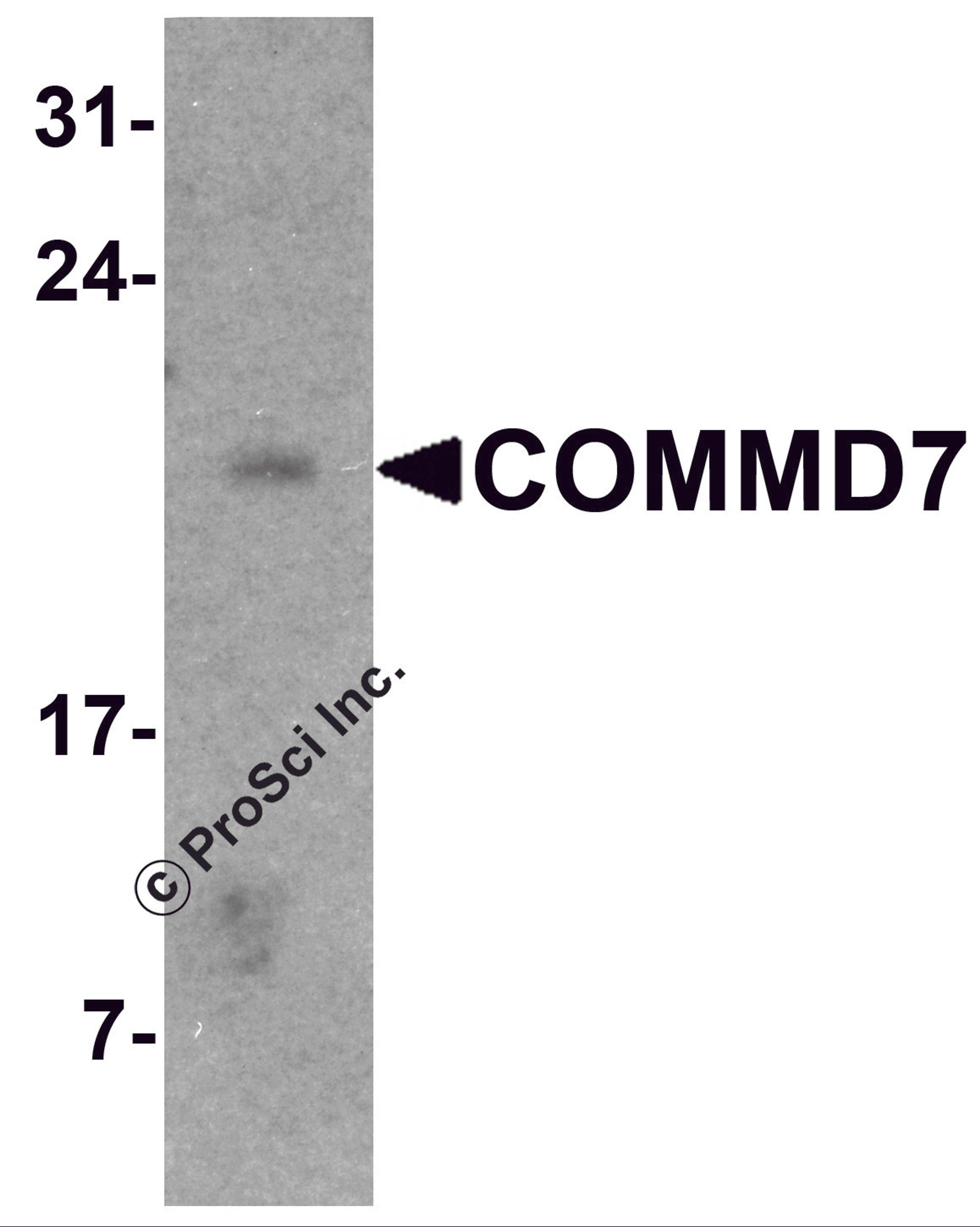 Western blot analysis of COMMD7 in mouse spleen tissue lysate with COMMD7 antibody at 1 μg/ml.